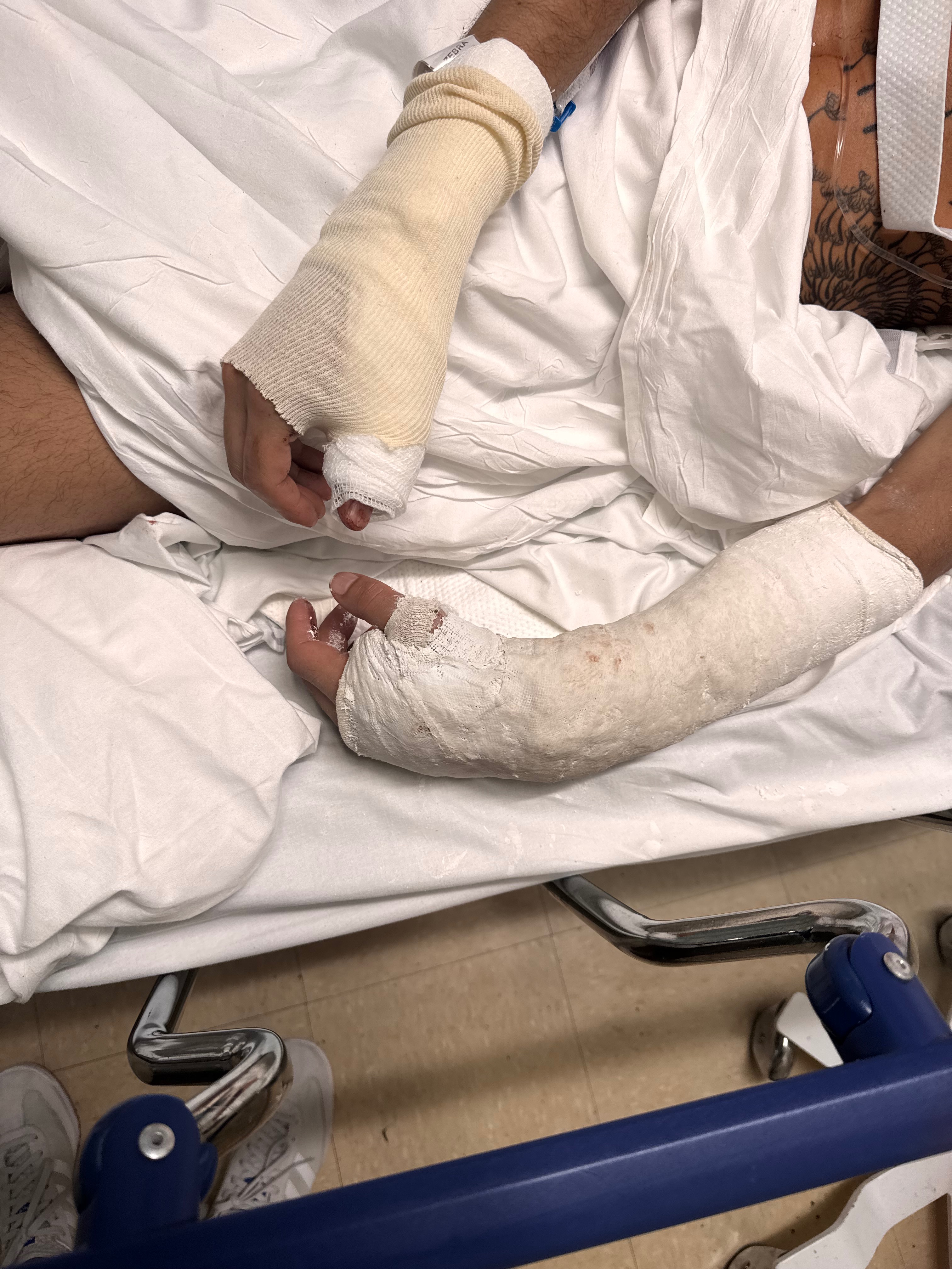Arturo's Journey to Recovery and Healing campaign photo, 6 of 8