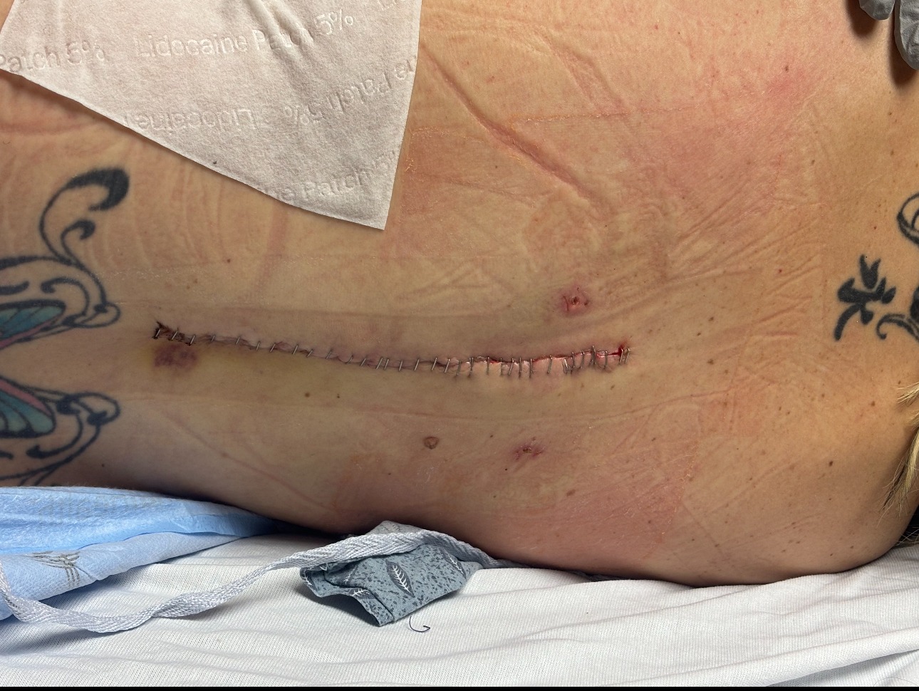 Help Ashley Walk Again After Car Accident campaign photo, 5 of 7
