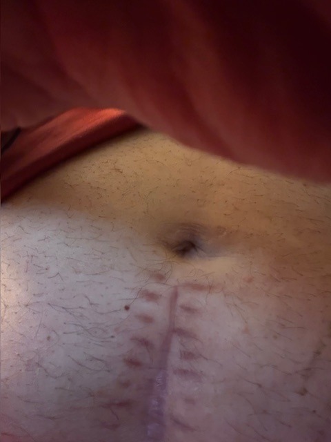 Help Todd Berry Afford Life-Saving Surgery campaign photo, 6 of 7