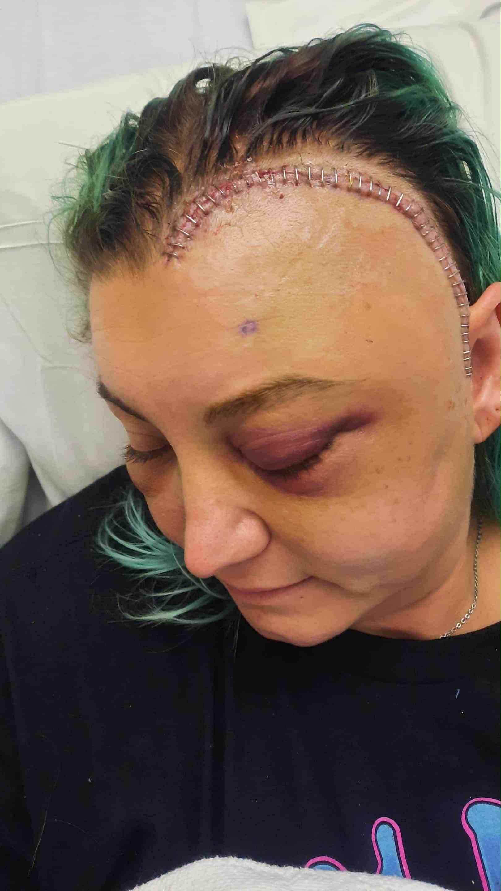 Support Crystal’s Battle Against A Brain Tumor campaign photo, 7 of 11