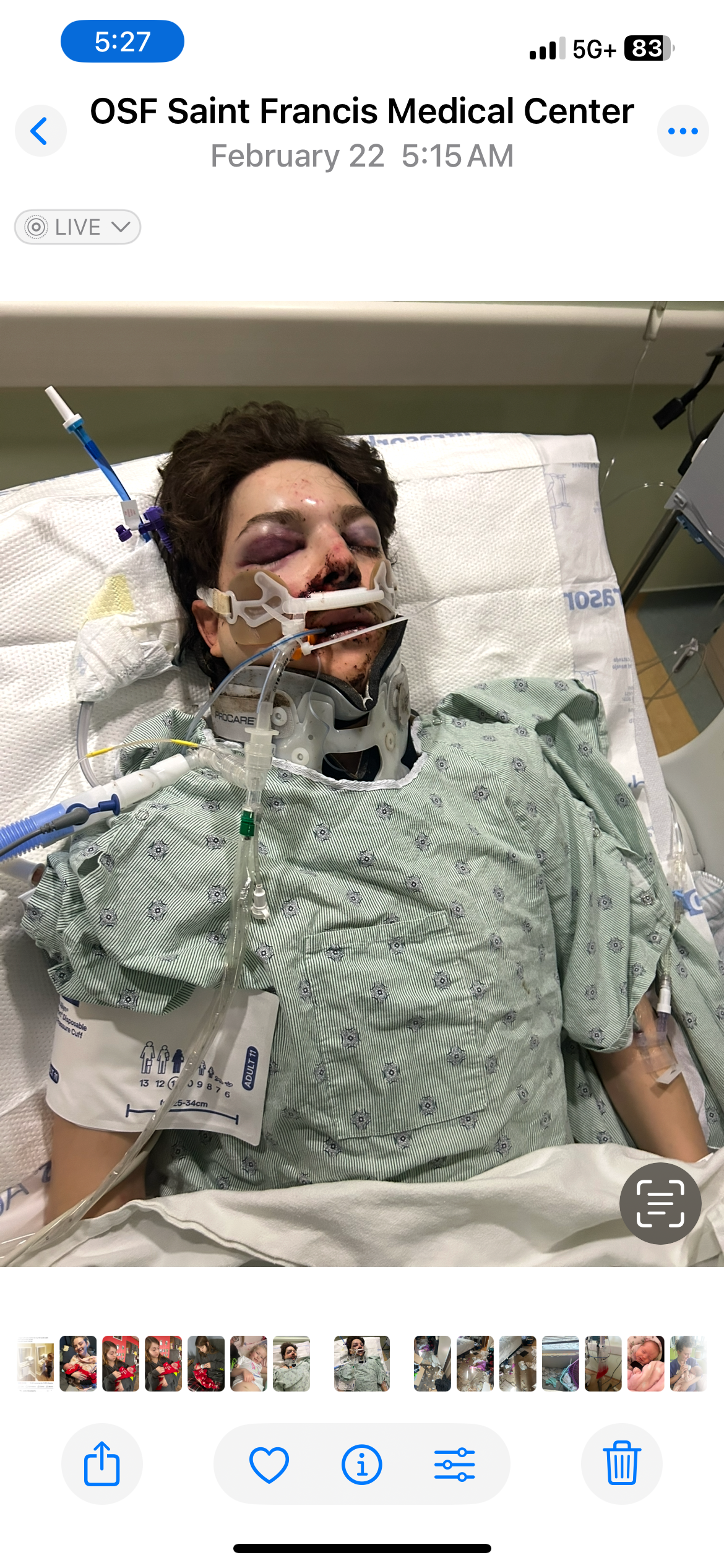My Son's Fight After Traumatic Accident campaign photo, 2 of 4