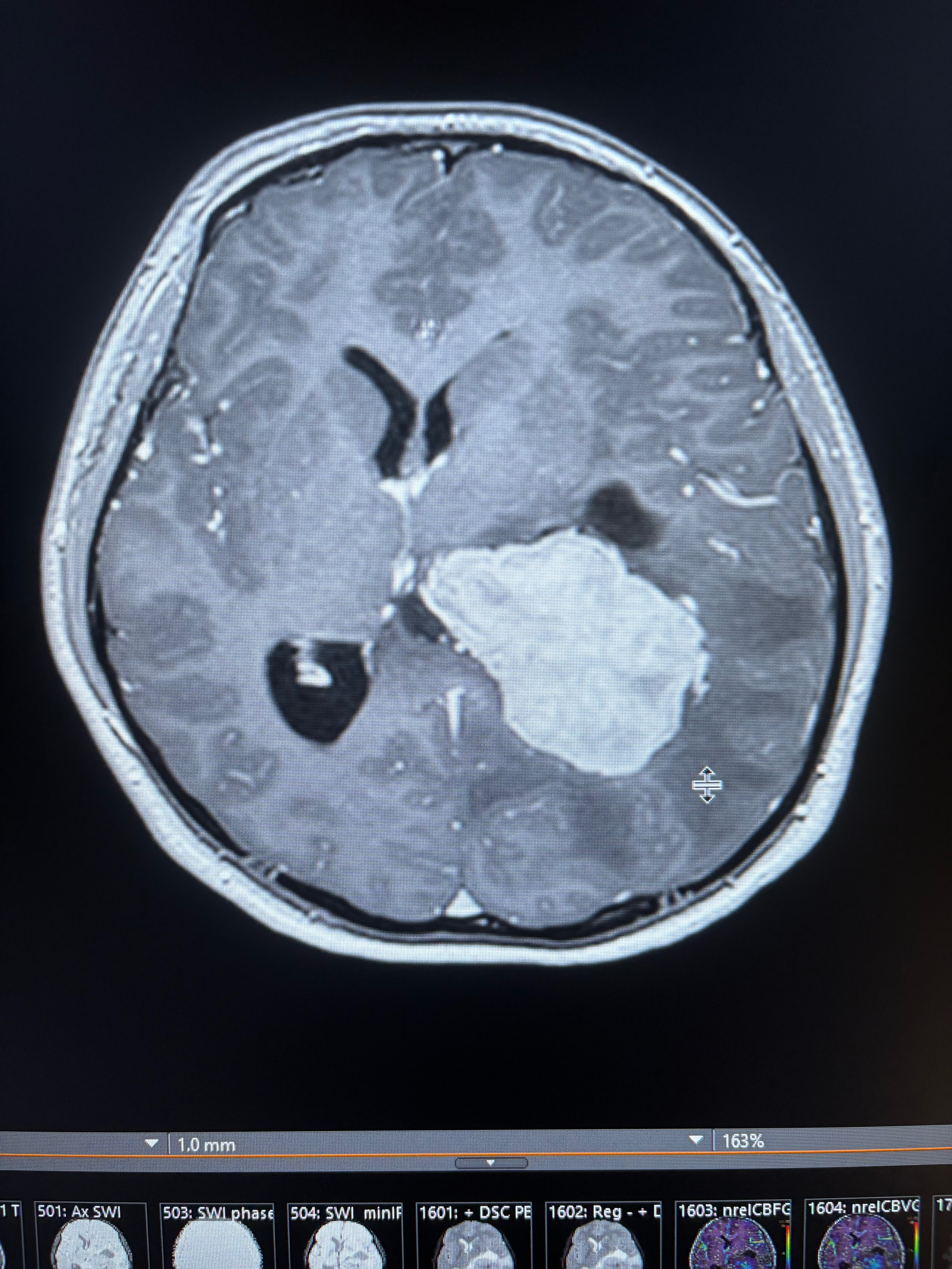 In Her Brain Surgery Era (Bailey’s Version) campaign photo, 6 of 8