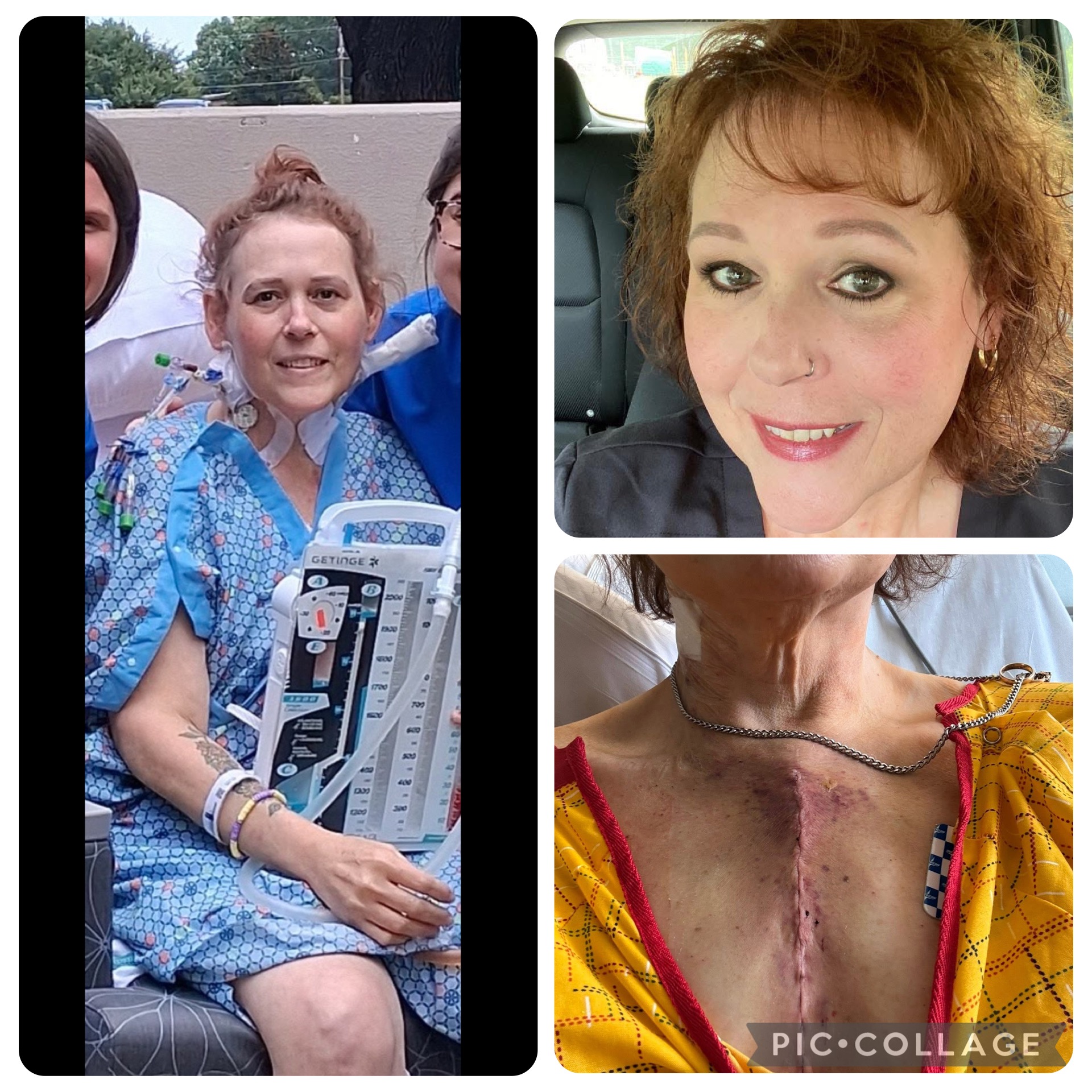Donate to Kathryne's Journey to Health campaign photo, 2 of 4