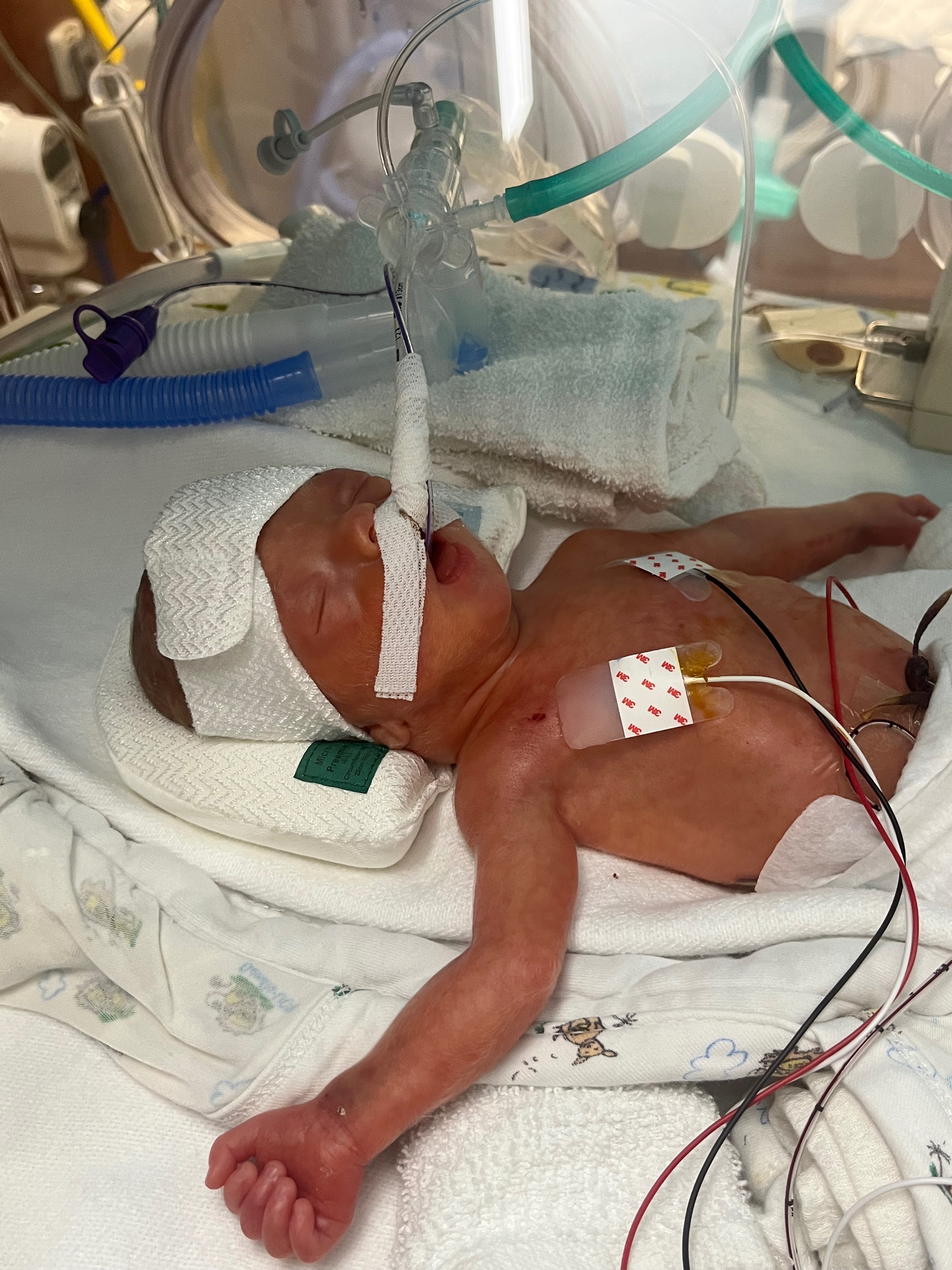 Support NICU Journey with Dillon campaign photo, 2 of 6