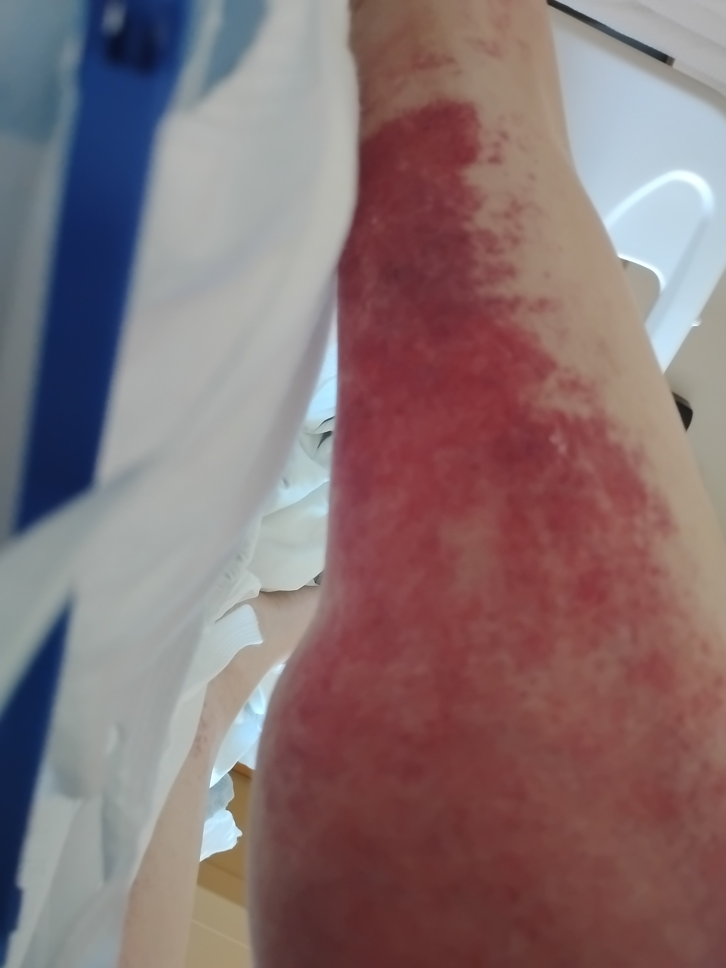 Jenn's Journey: Battling Multiple Illnesses campaign photo, 7 of 8