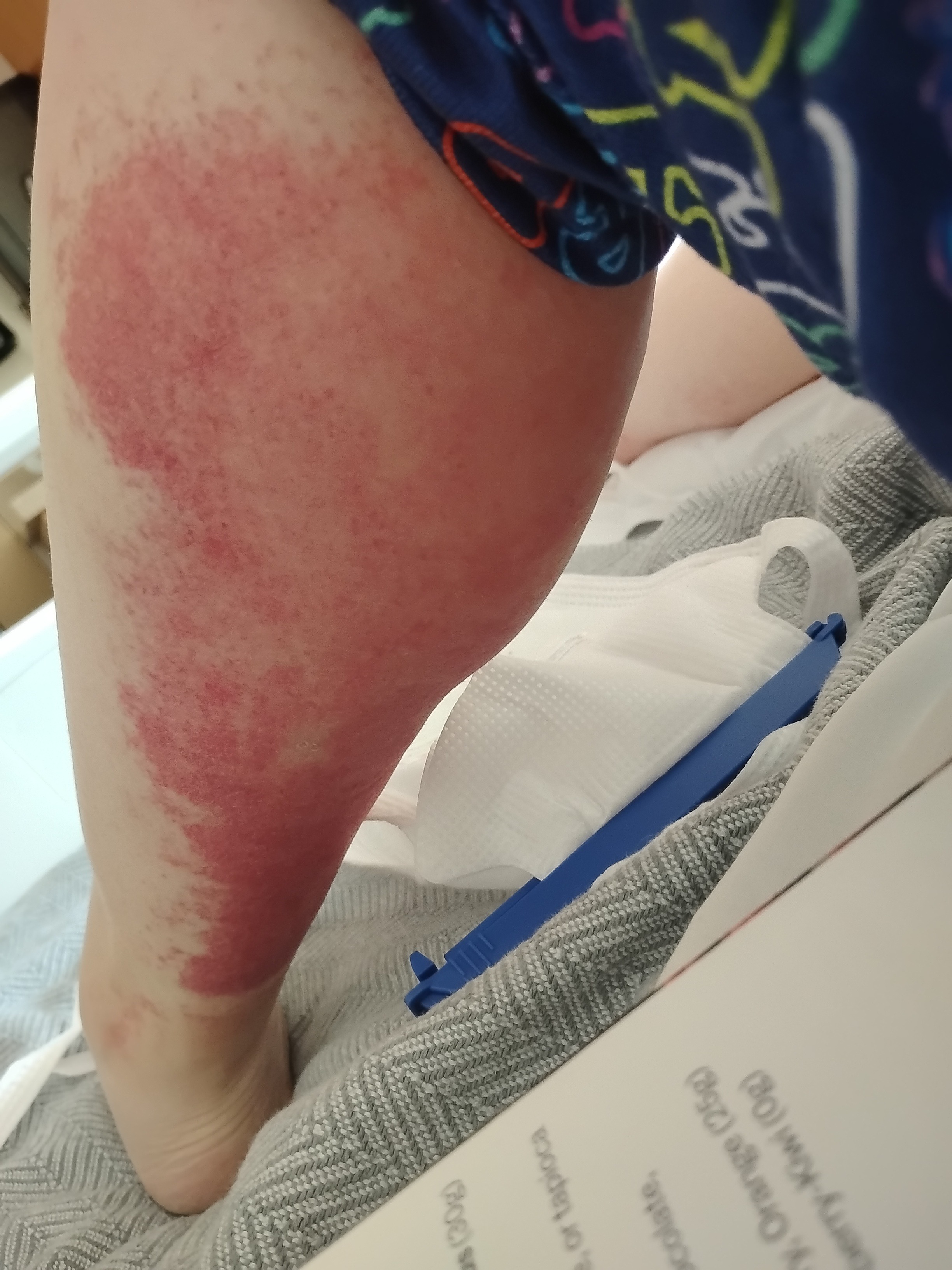 Jenn's Journey: Battling Multiple Illnesses campaign photo, 2 of 8