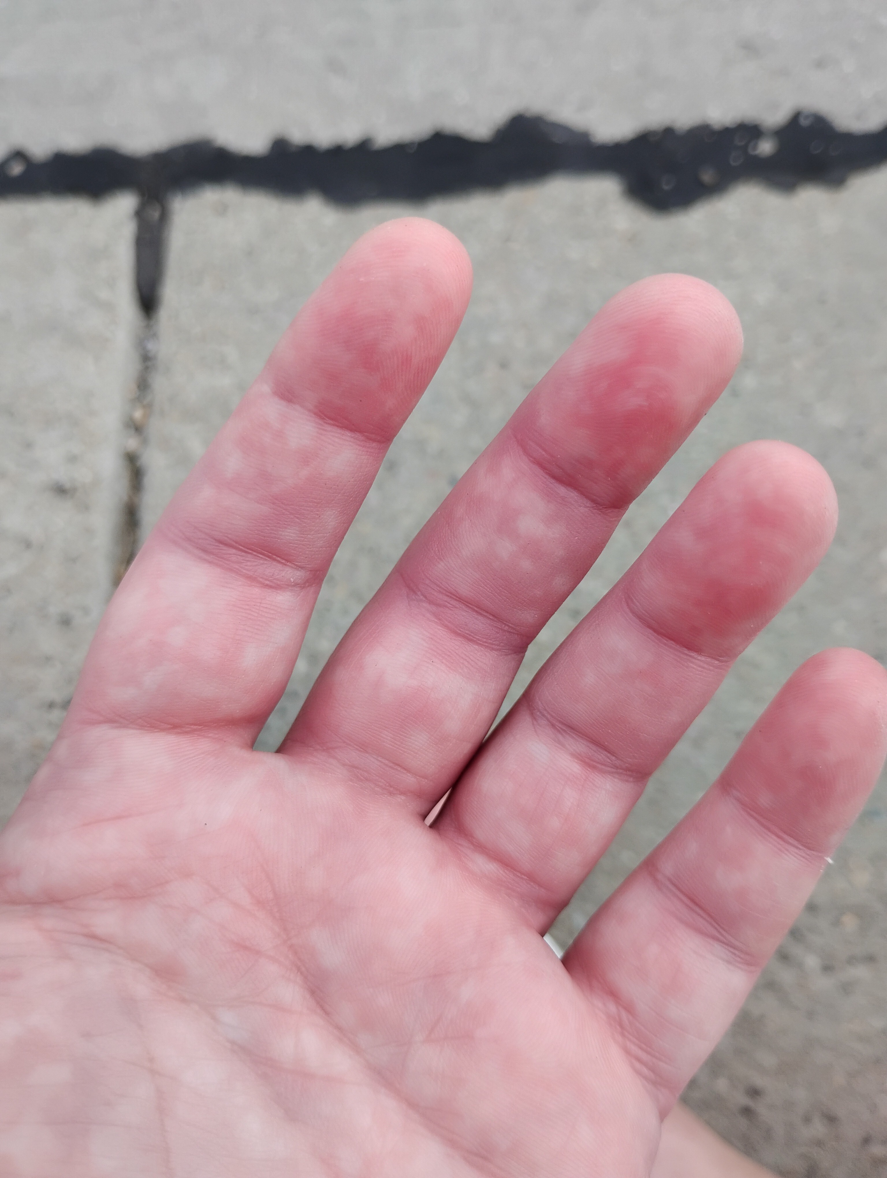 Jenn's Journey: Battling Multiple Illnesses campaign photo, 5 of 8