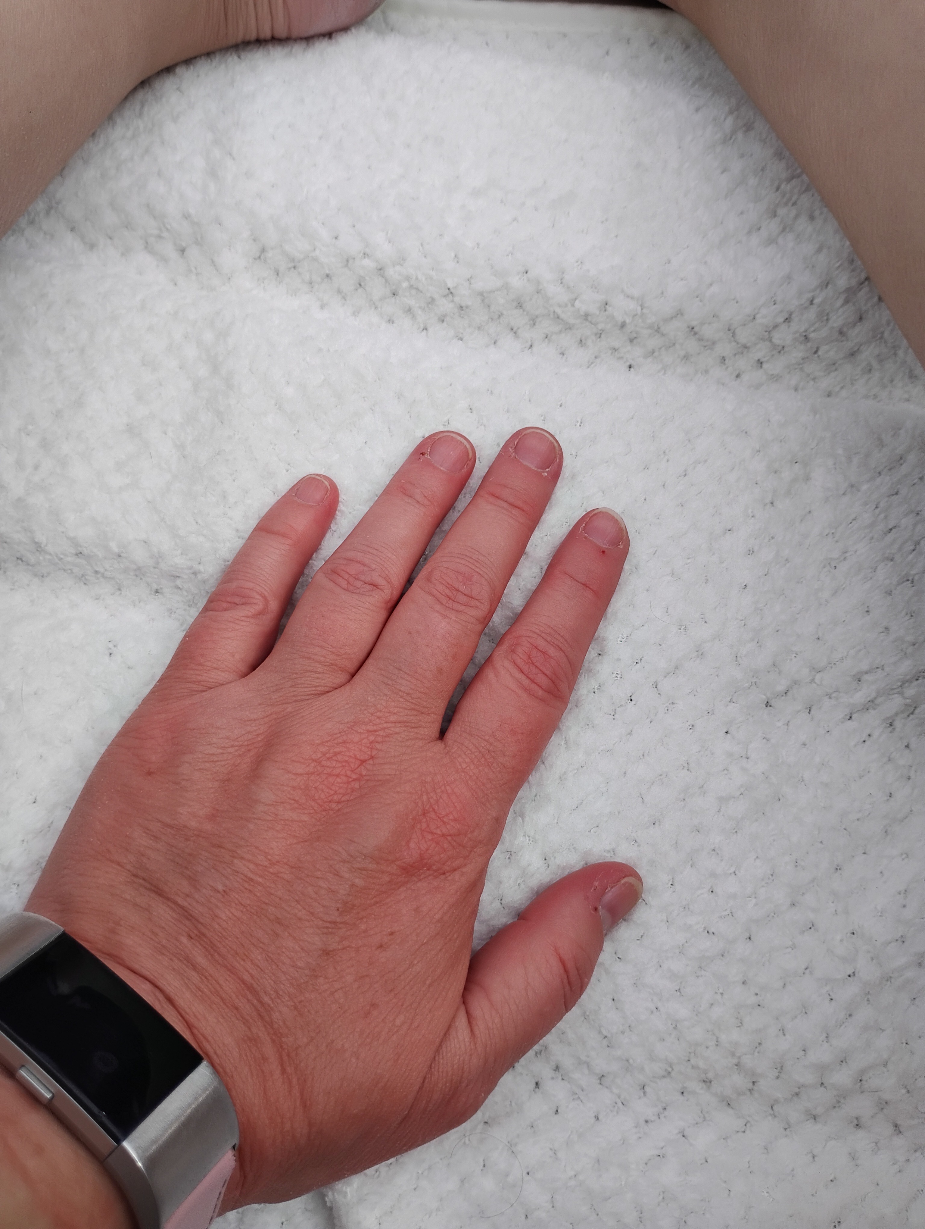 Jenn's Journey: Battling Multiple Illnesses campaign photo, 6 of 8
