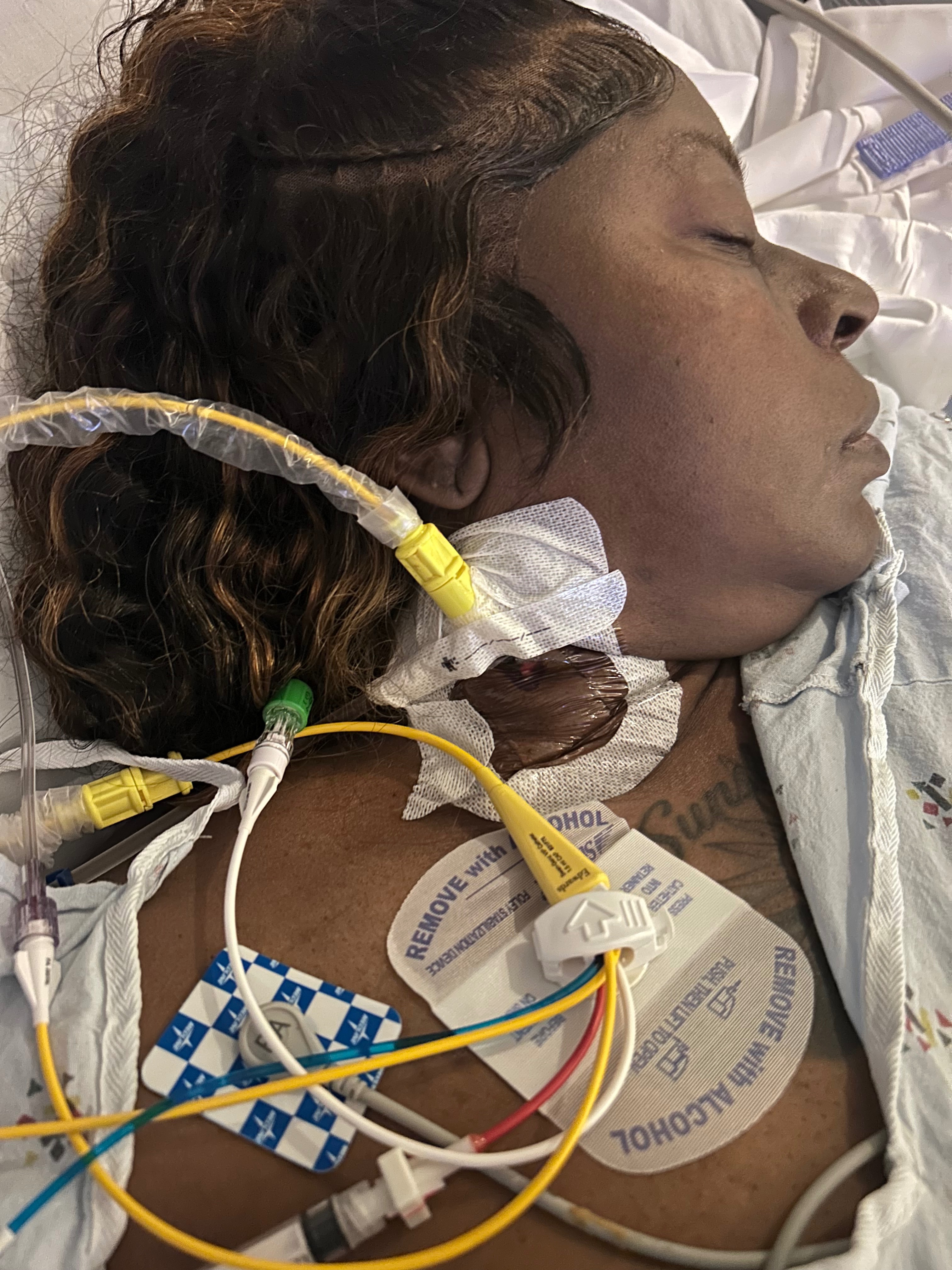 Donate to help Melissa as she battles with heart failure campaign photo, 2 of 3
