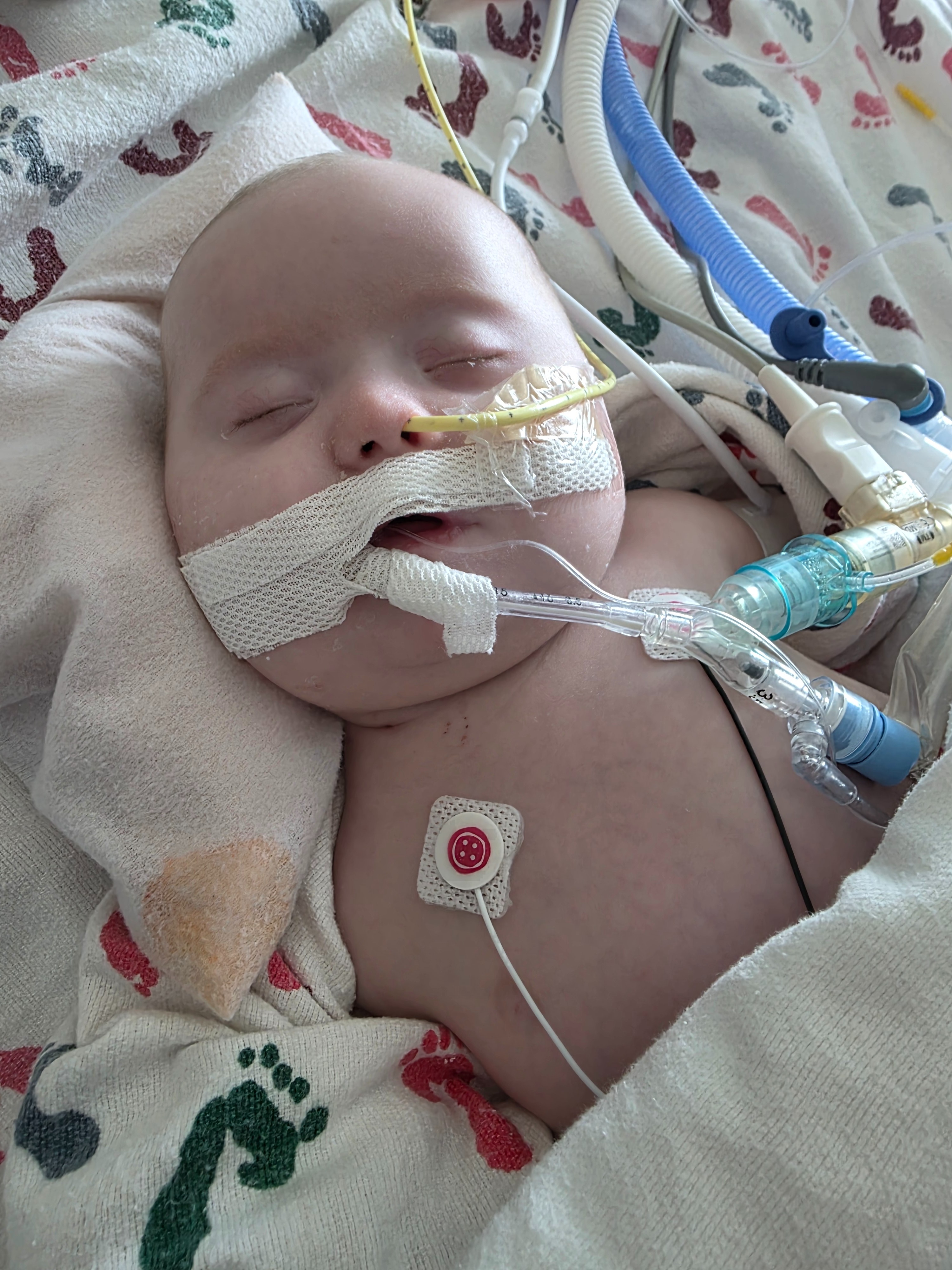 Help Easton Get the Care He Needs campaign photo, 5 of 6