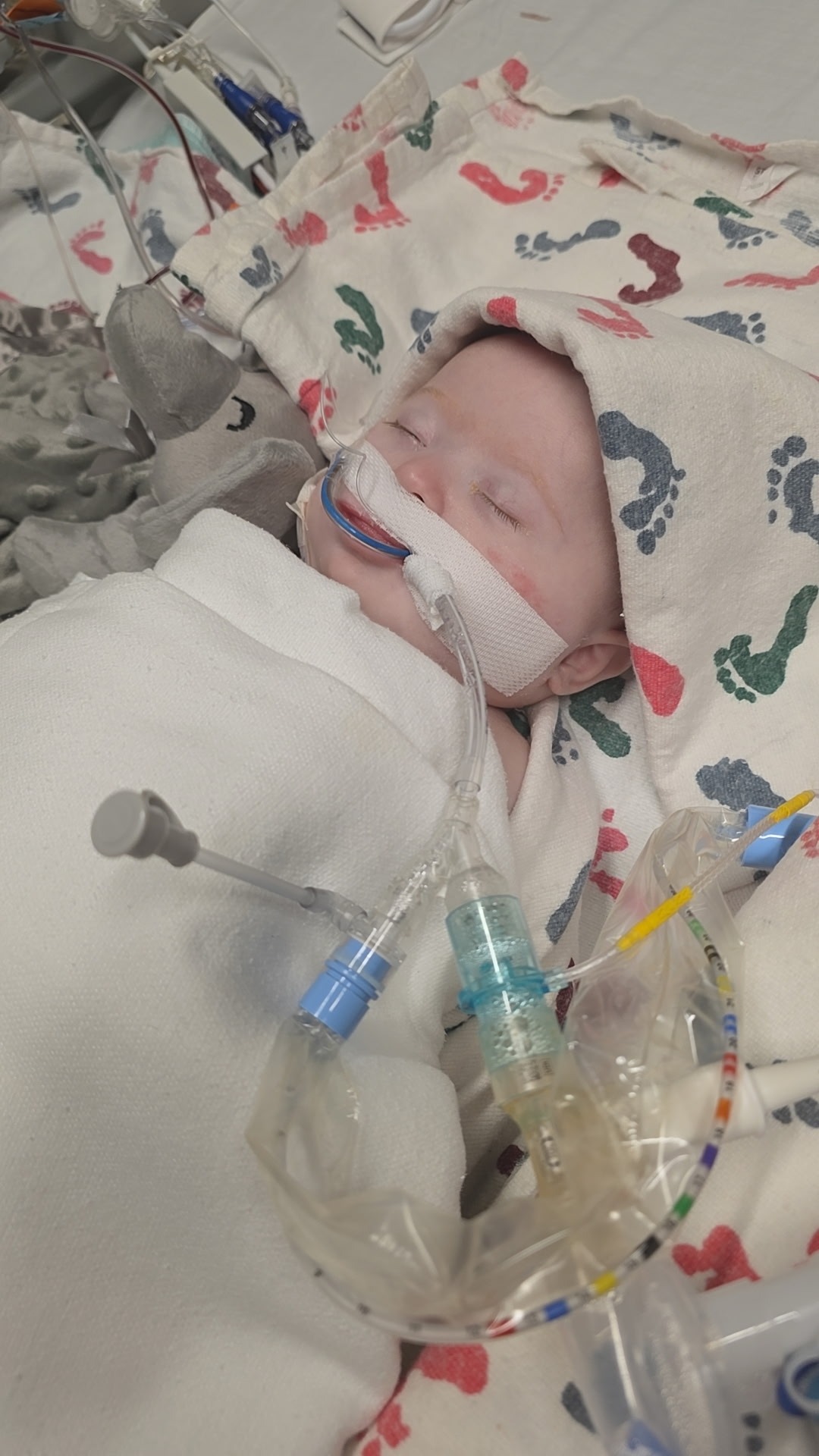 Help Easton Get the Care He Needs campaign photo, 4 of 6