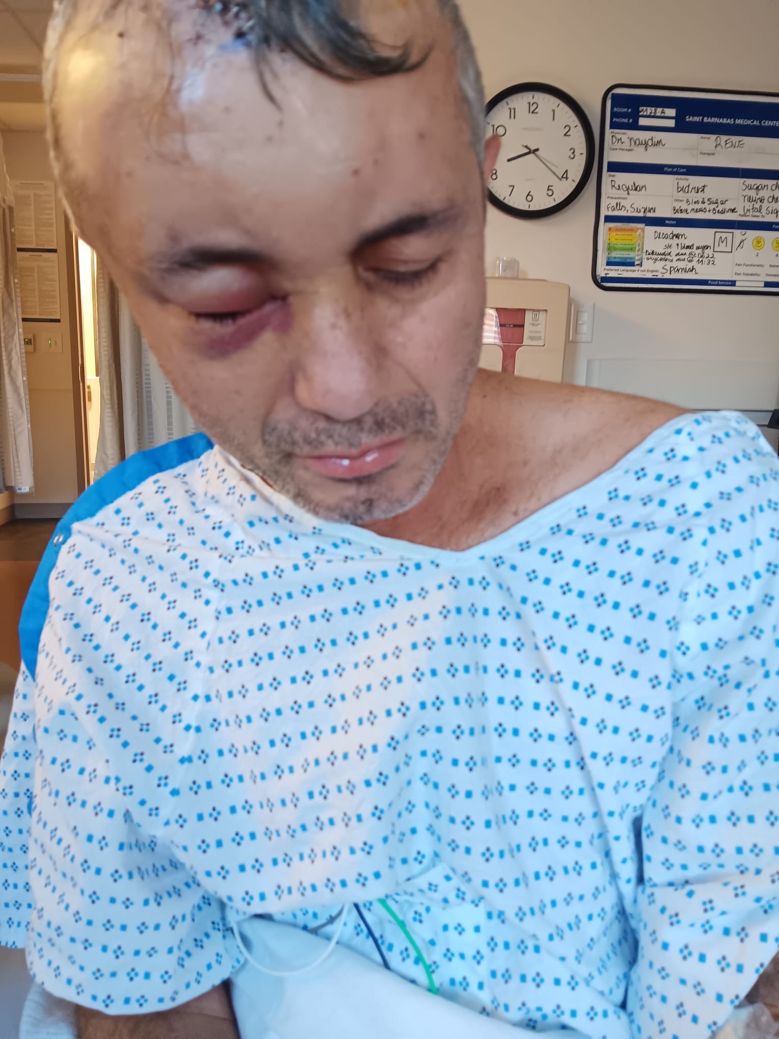 Urgent help for Fidel Arias campaign photo, 4 of 8