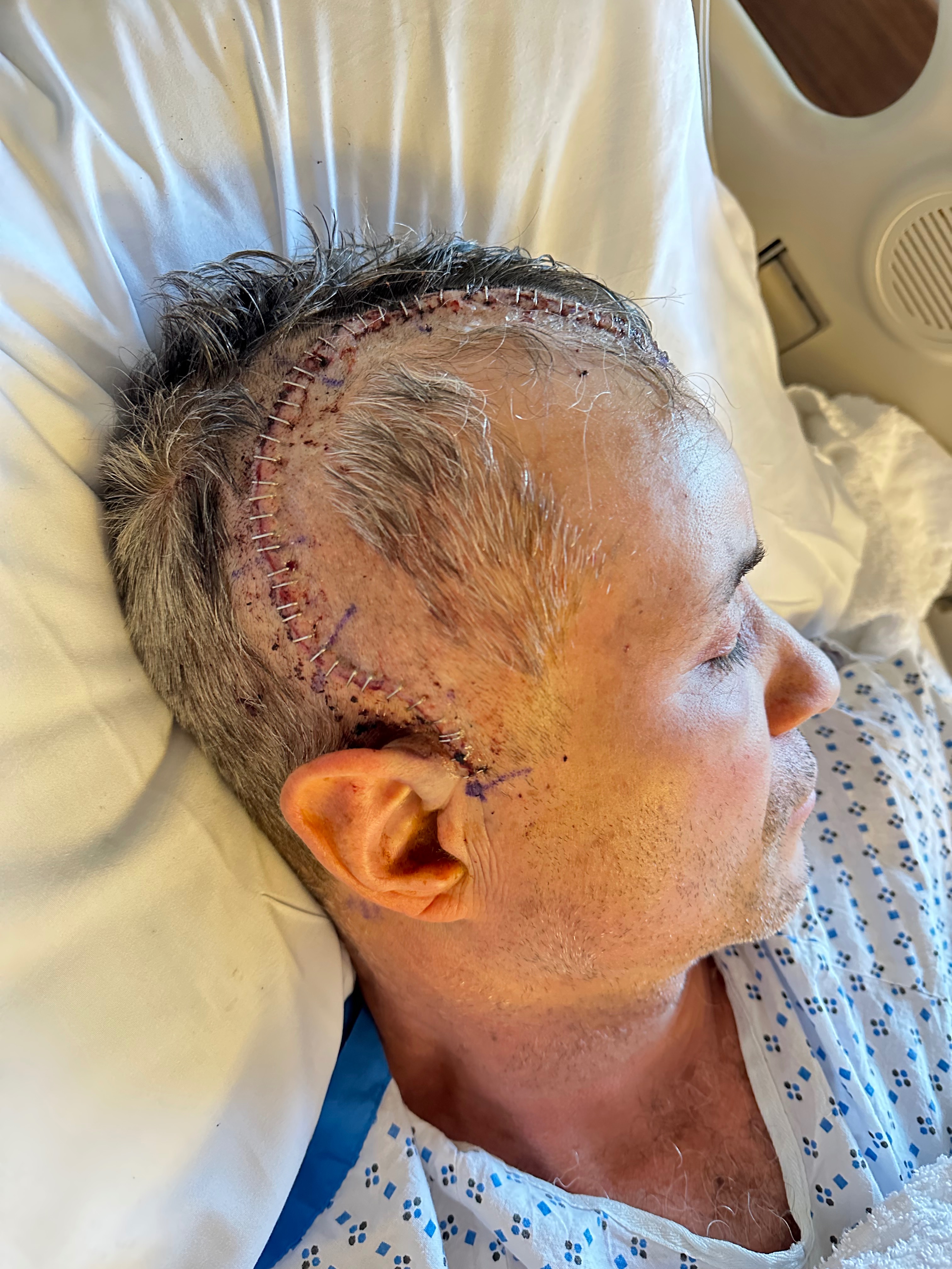 Urgent help for Fidel Arias campaign photo, 6 of 8