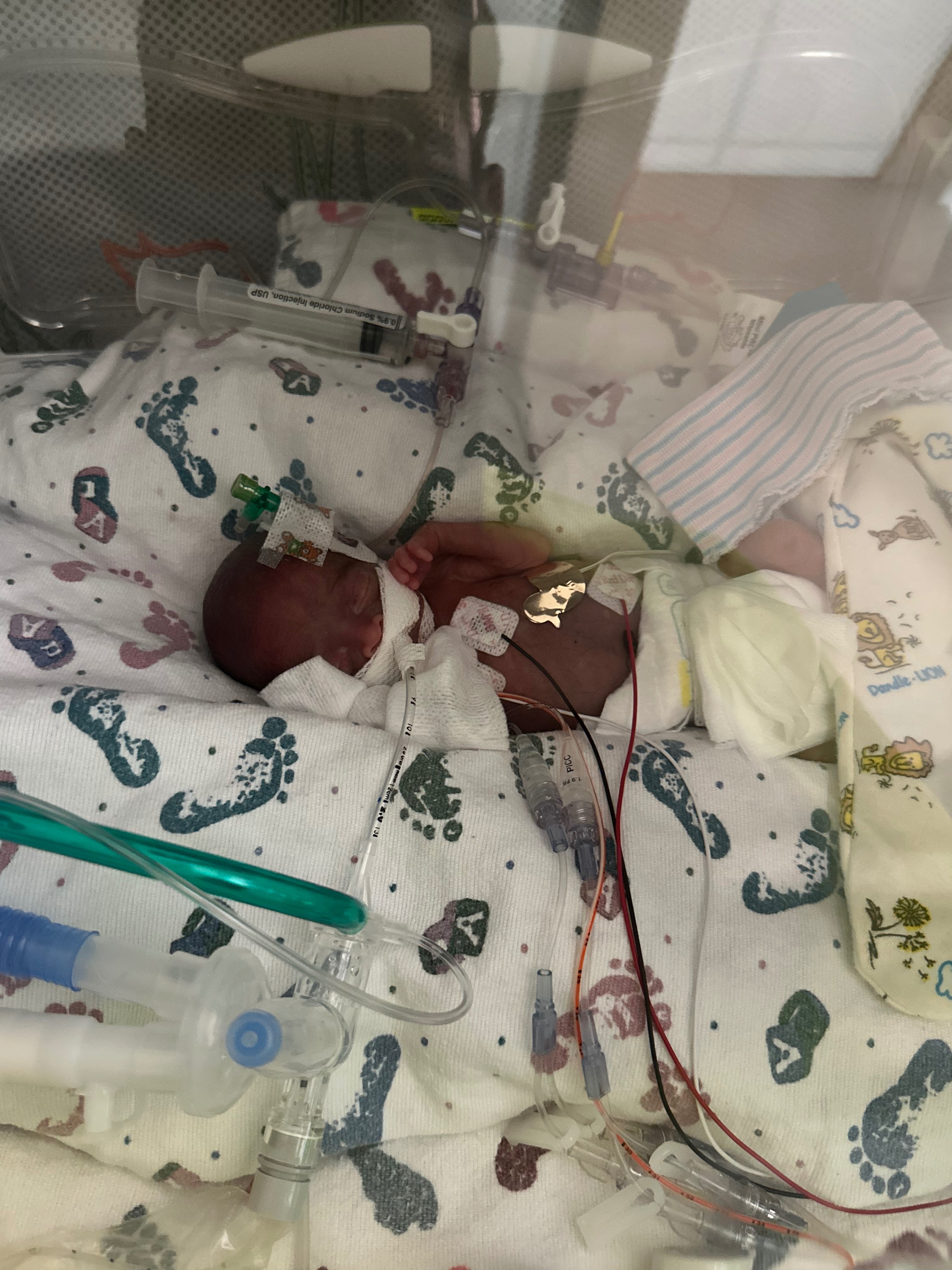 Help Cover Tristan Michael's Funeral Expenses campaign photo, 2 of 3