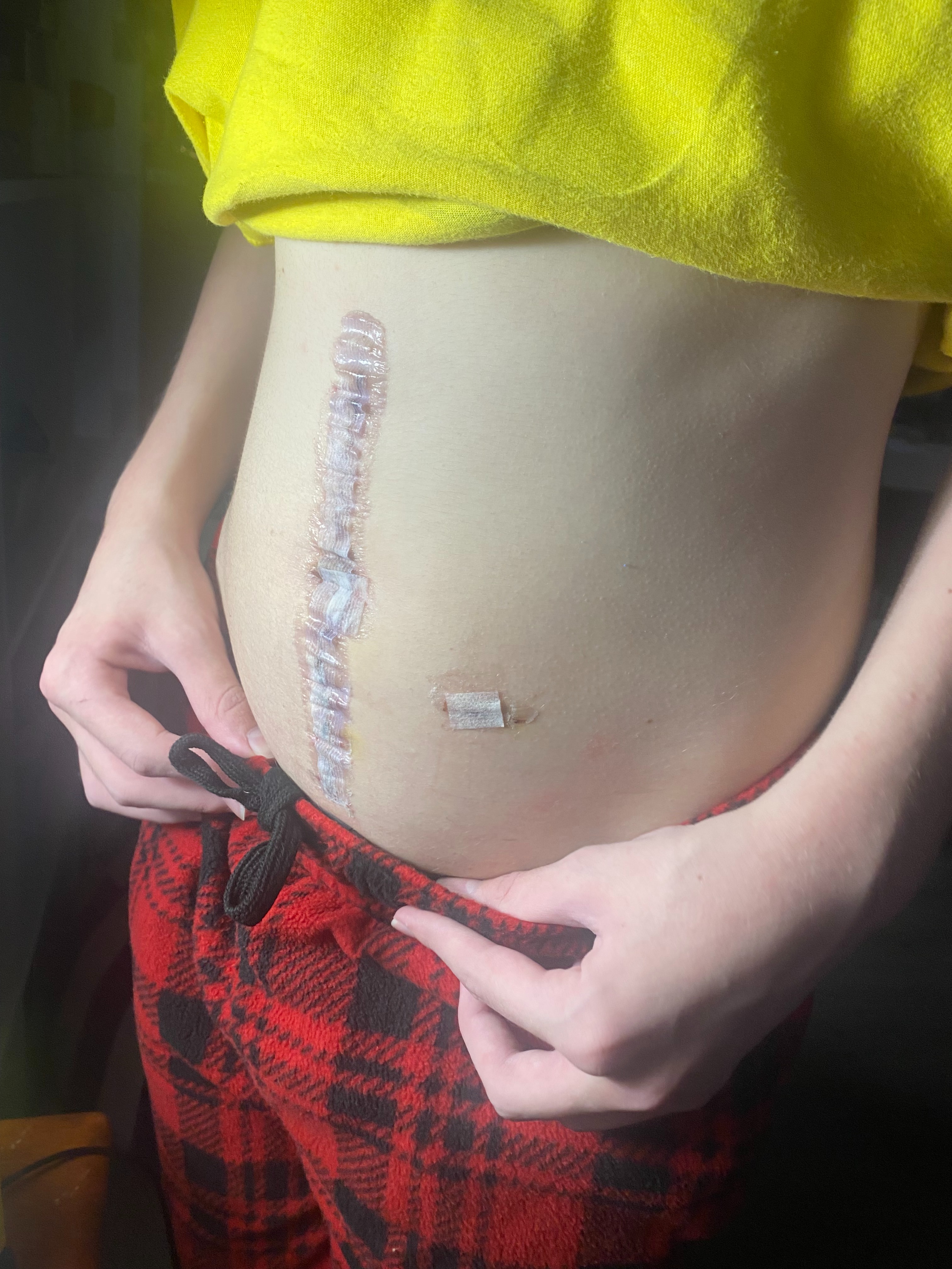 Support Owen's Battle with Ruptured Appendix campaign photo, 7 of 8