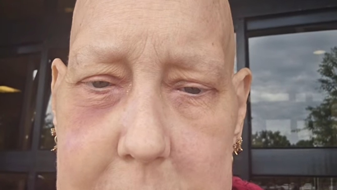 Keep Our Home: Support for Chemo and Bills