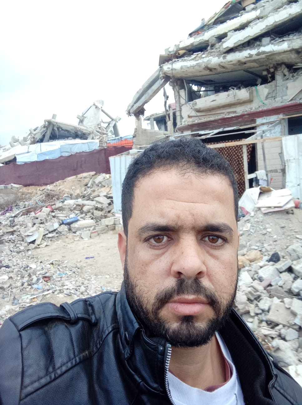 Save Muhammad and His Injured Son: A Life Left in Rubble campaign photo, 2 of 4