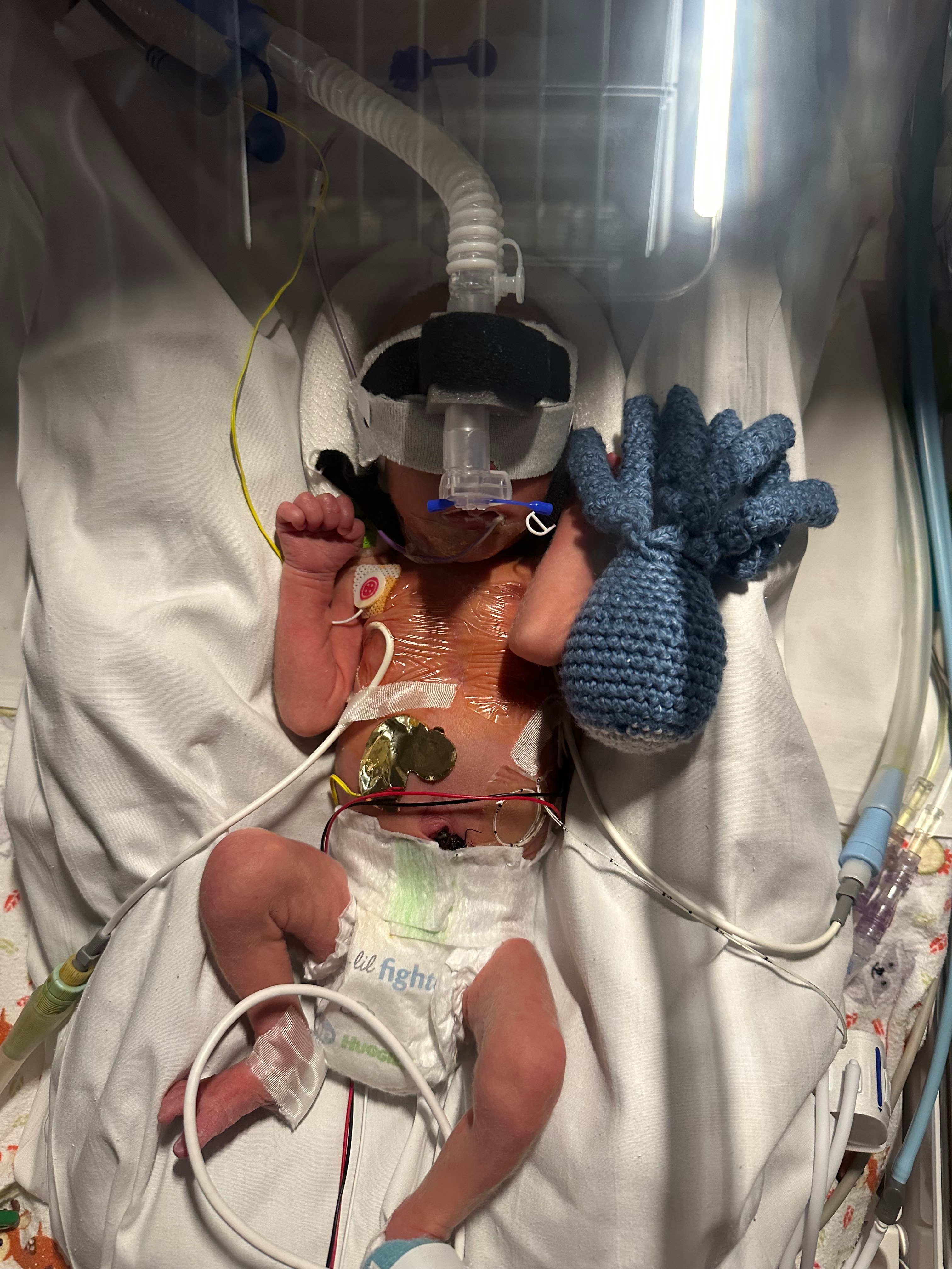 Support Matthew's Journey from NICU to Home campaign photo, 5 of 6
