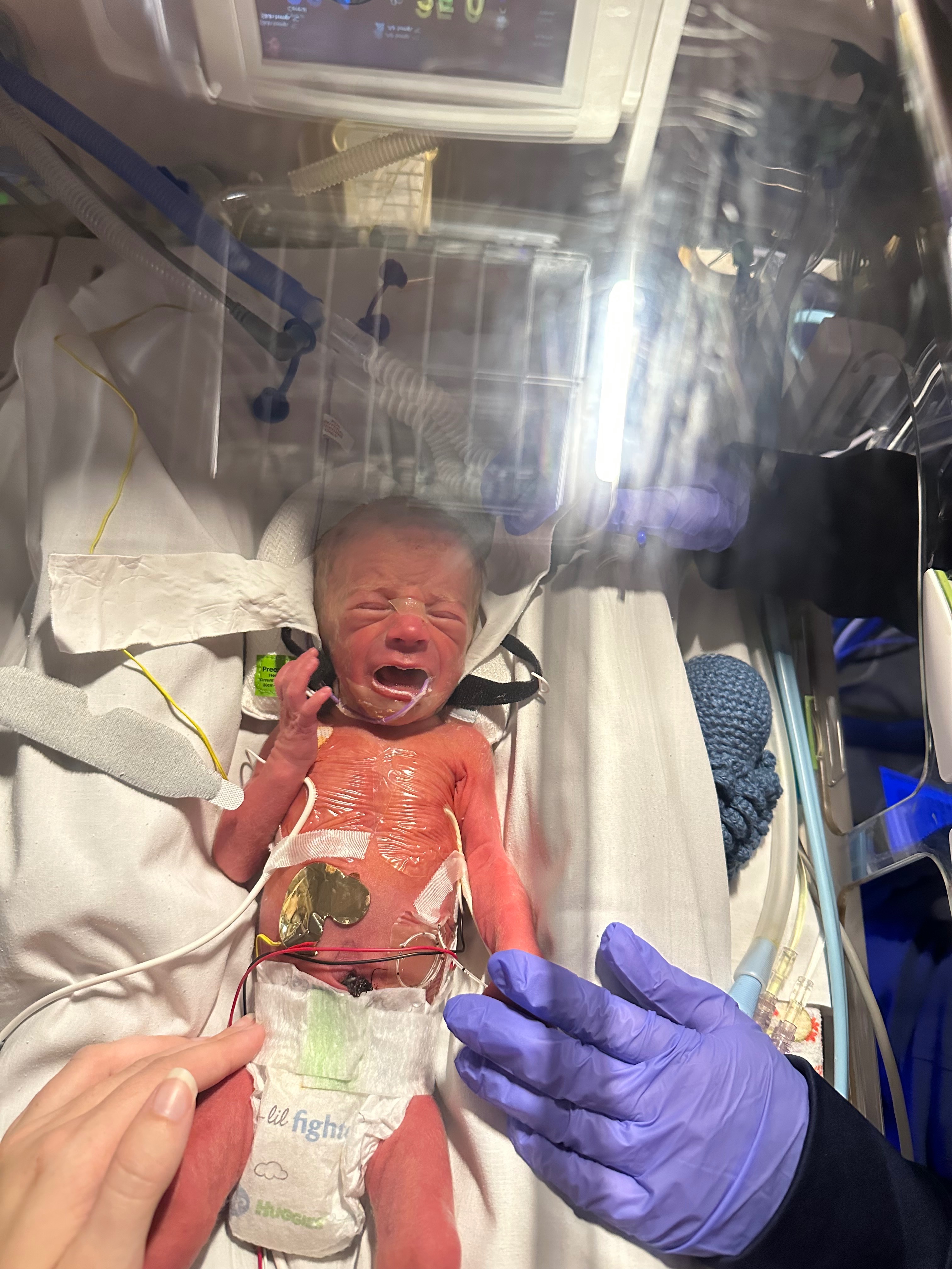Support Matthew's Journey from NICU to Home campaign photo, 2 of 6