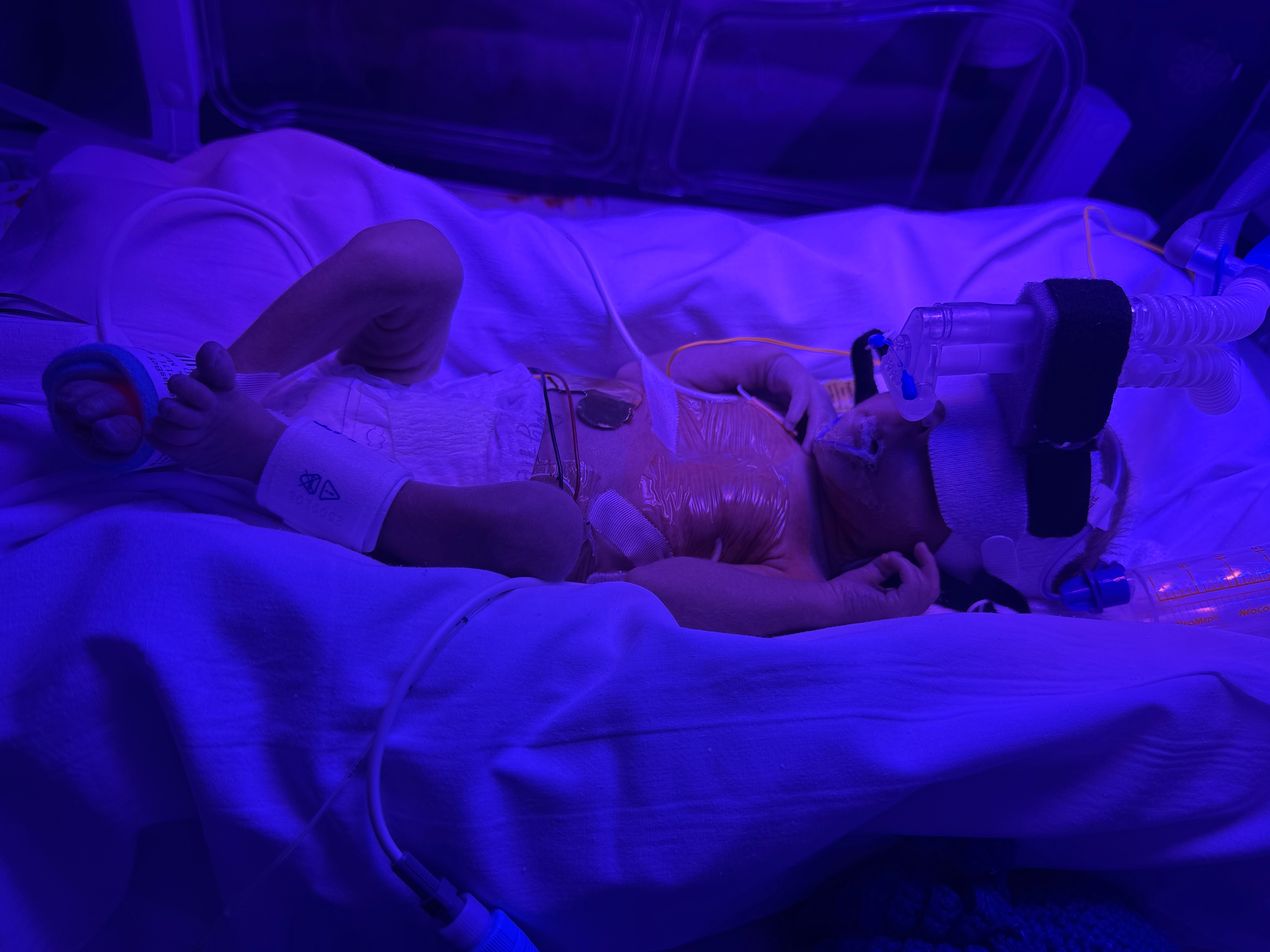 Support Matthew's Journey from NICU to Home campaign photo, 4 of 6