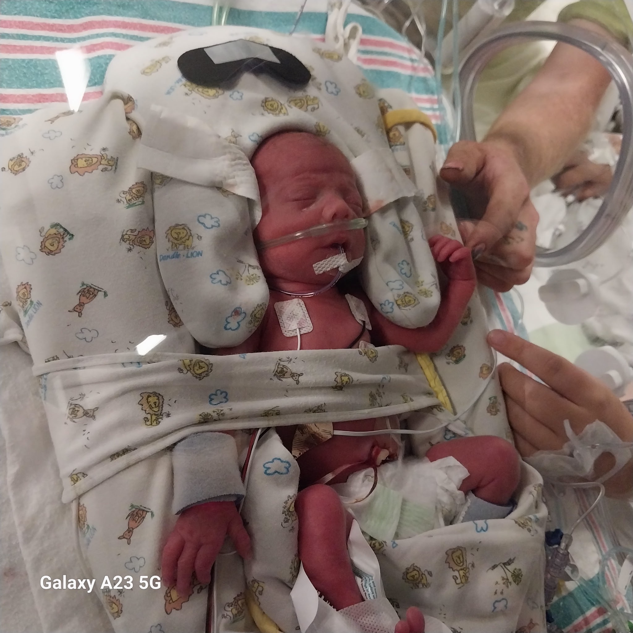Help Ryan and Jess during Baby Emilia's NICU Care campaign photo, 7 of 8