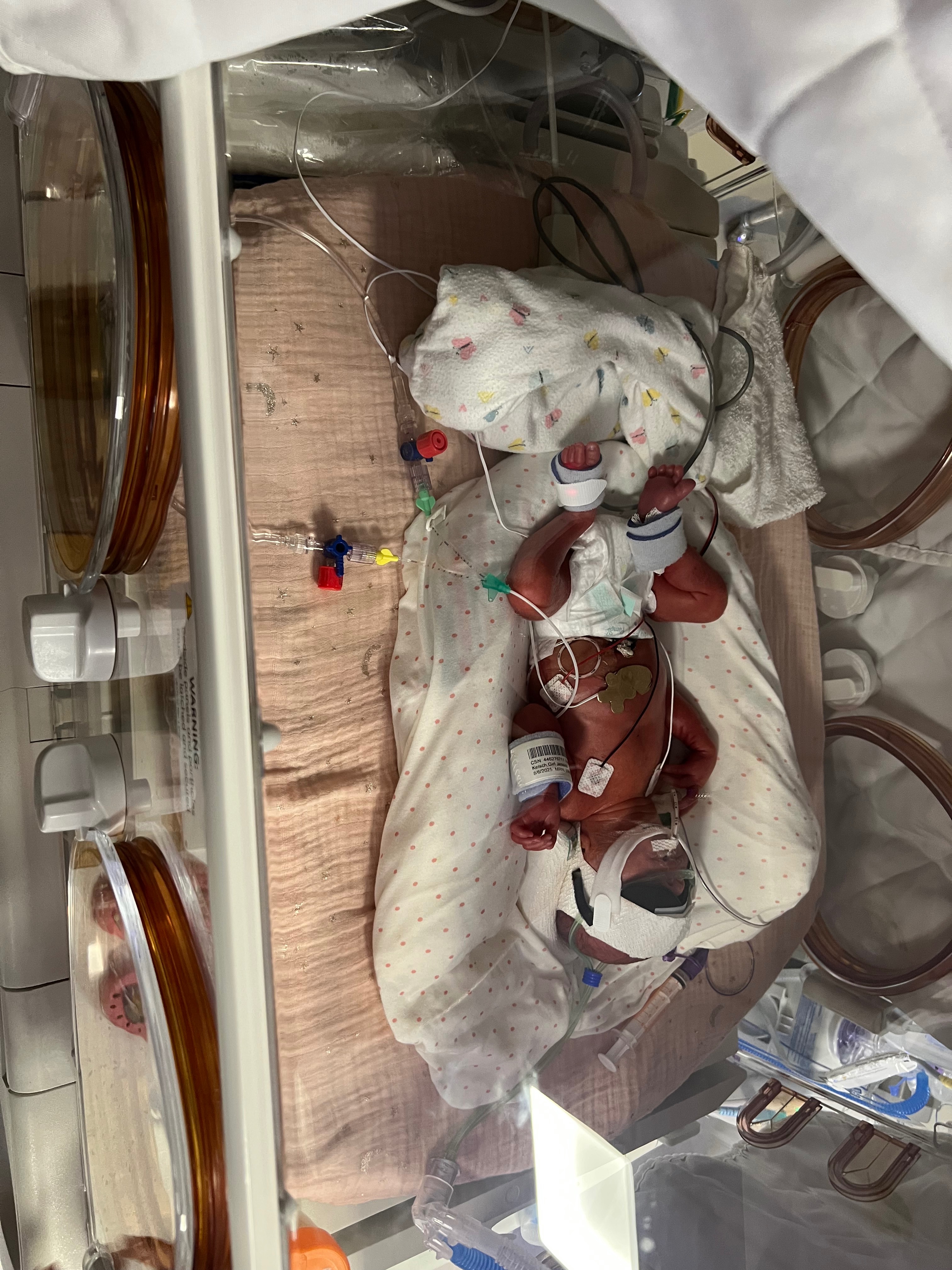 Help Ryan and Jess during Baby Emilia's NICU Care campaign photo, 2 of 8