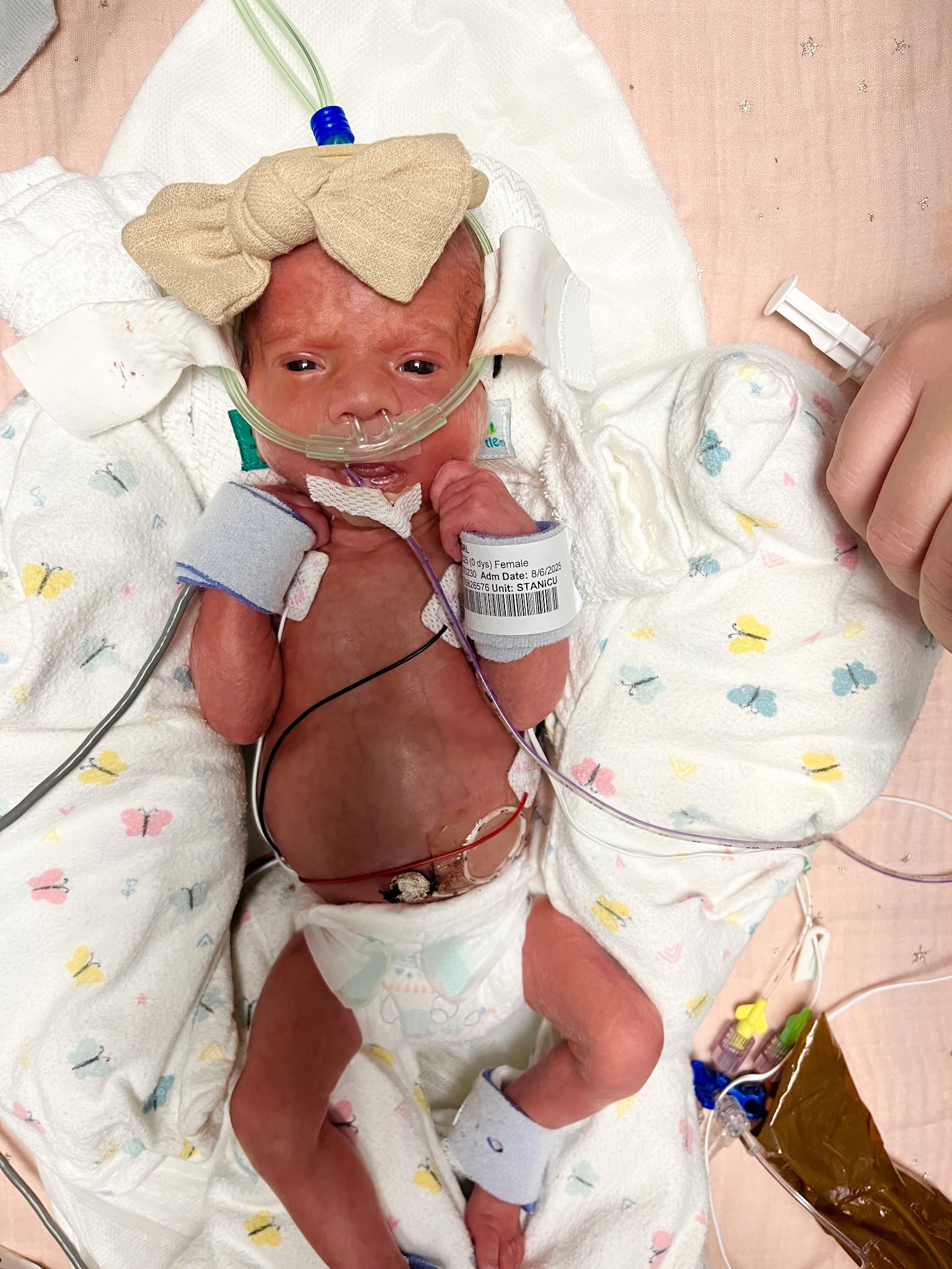 Help Ryan and Jess during Baby Emilia's NICU Care campaign photo, 5 of 8