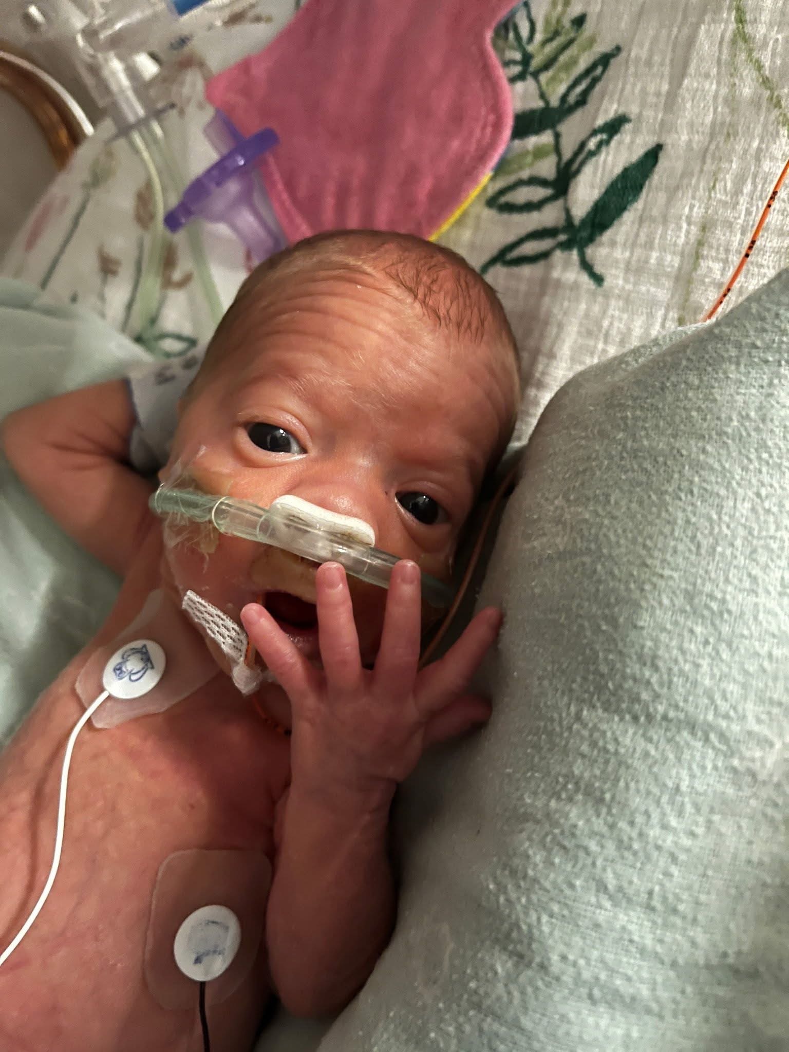 Help Ryan and Jess during Baby Emilia's NICU Care campaign photo, 6 of 8