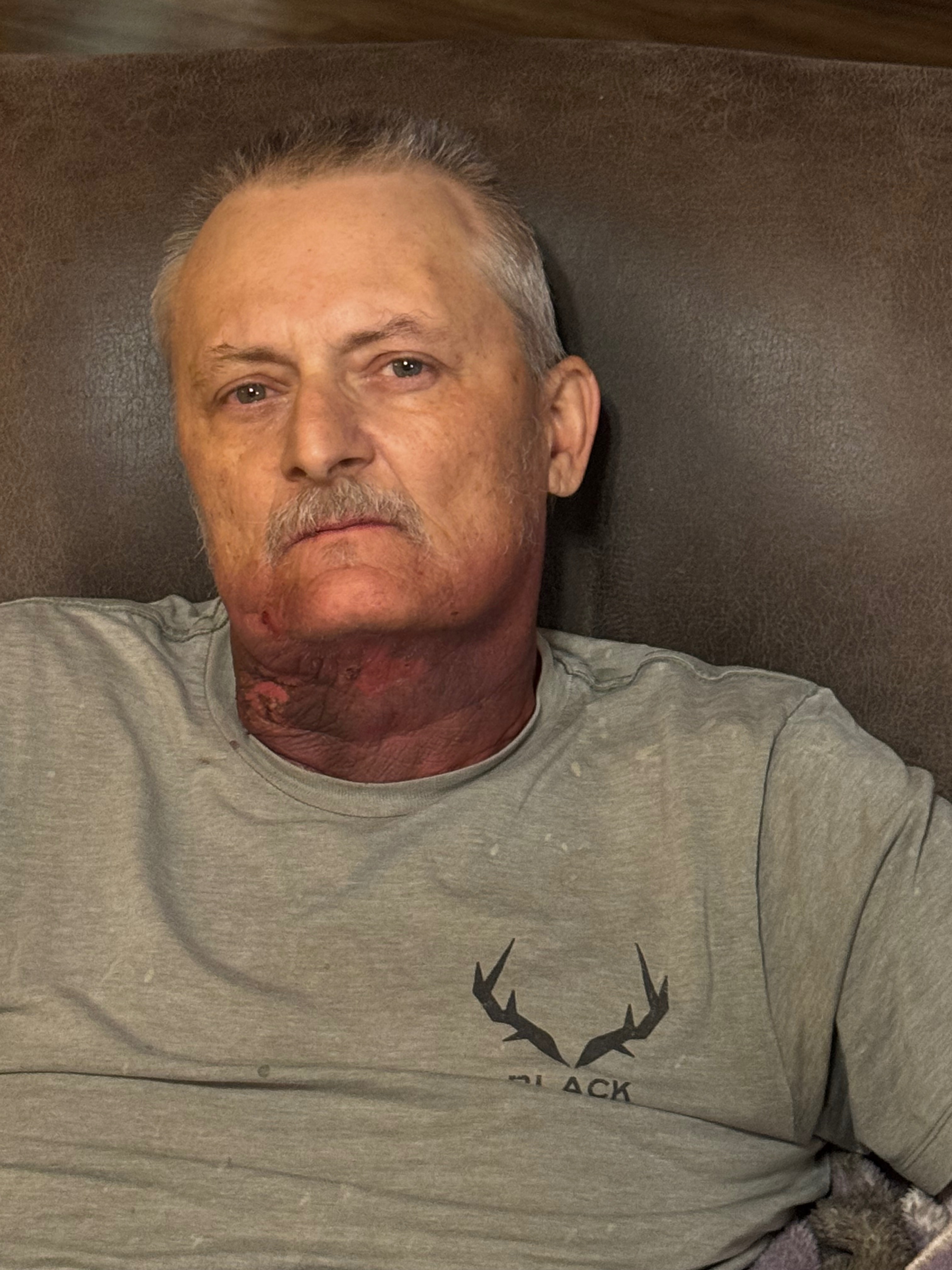 Donate to Kevin Thibodeaux's Healing Journey campaign photo, 2 of 4