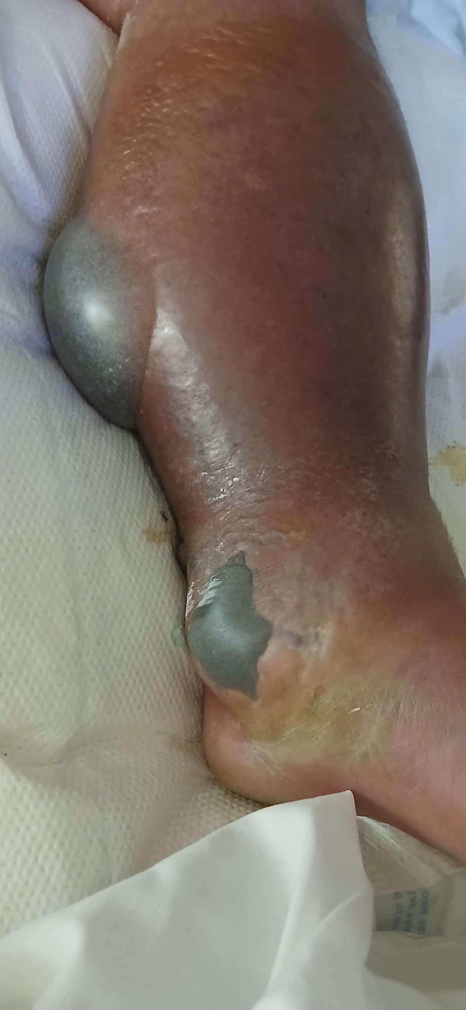 Urgent Aid for My Best Friend's Recovery campaign photo, 7 of 8