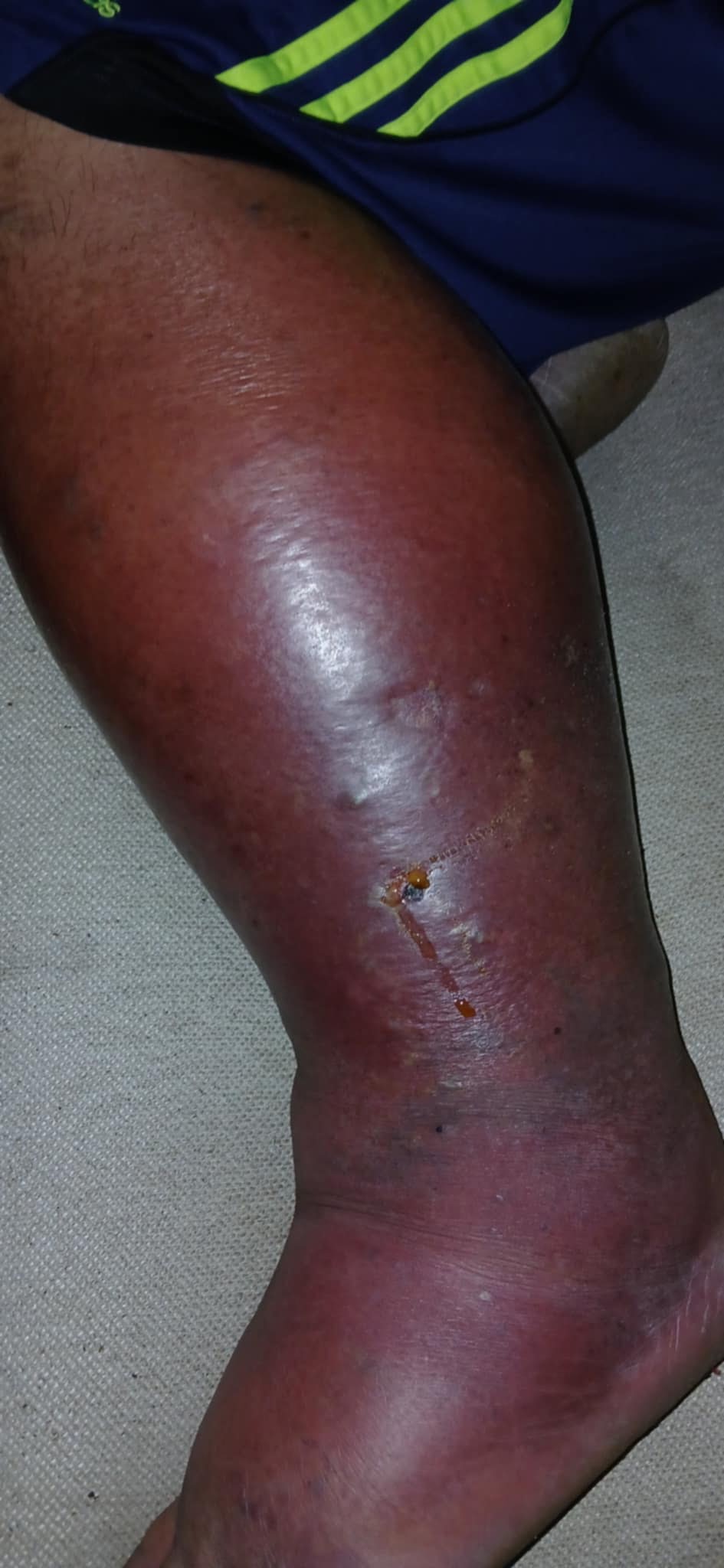 Urgent Aid for My Best Friend's Recovery campaign photo, 2 of 8