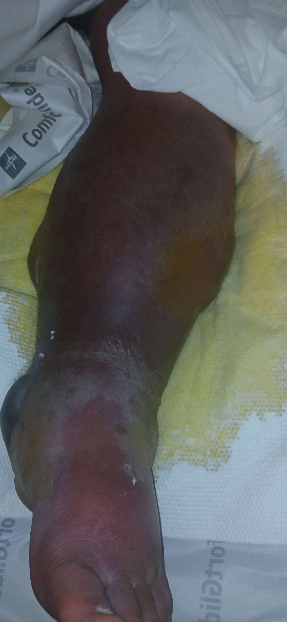 Urgent Aid for My Best Friend's Recovery campaign photo, 4 of 8