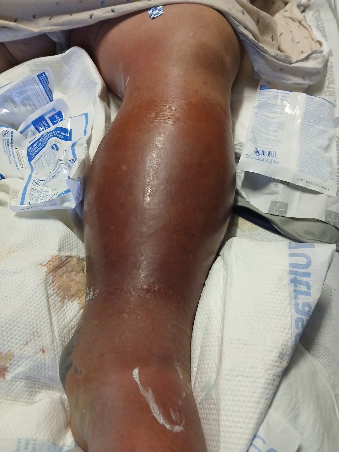 Urgent Aid for My Best Friend's Recovery campaign photo, 5 of 8