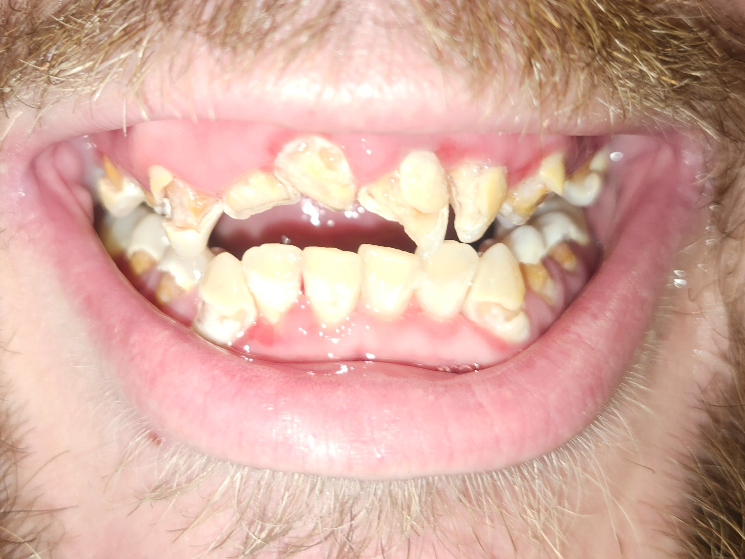 Help Casey Smile Again After Cancer campaign photo, 7 of 8