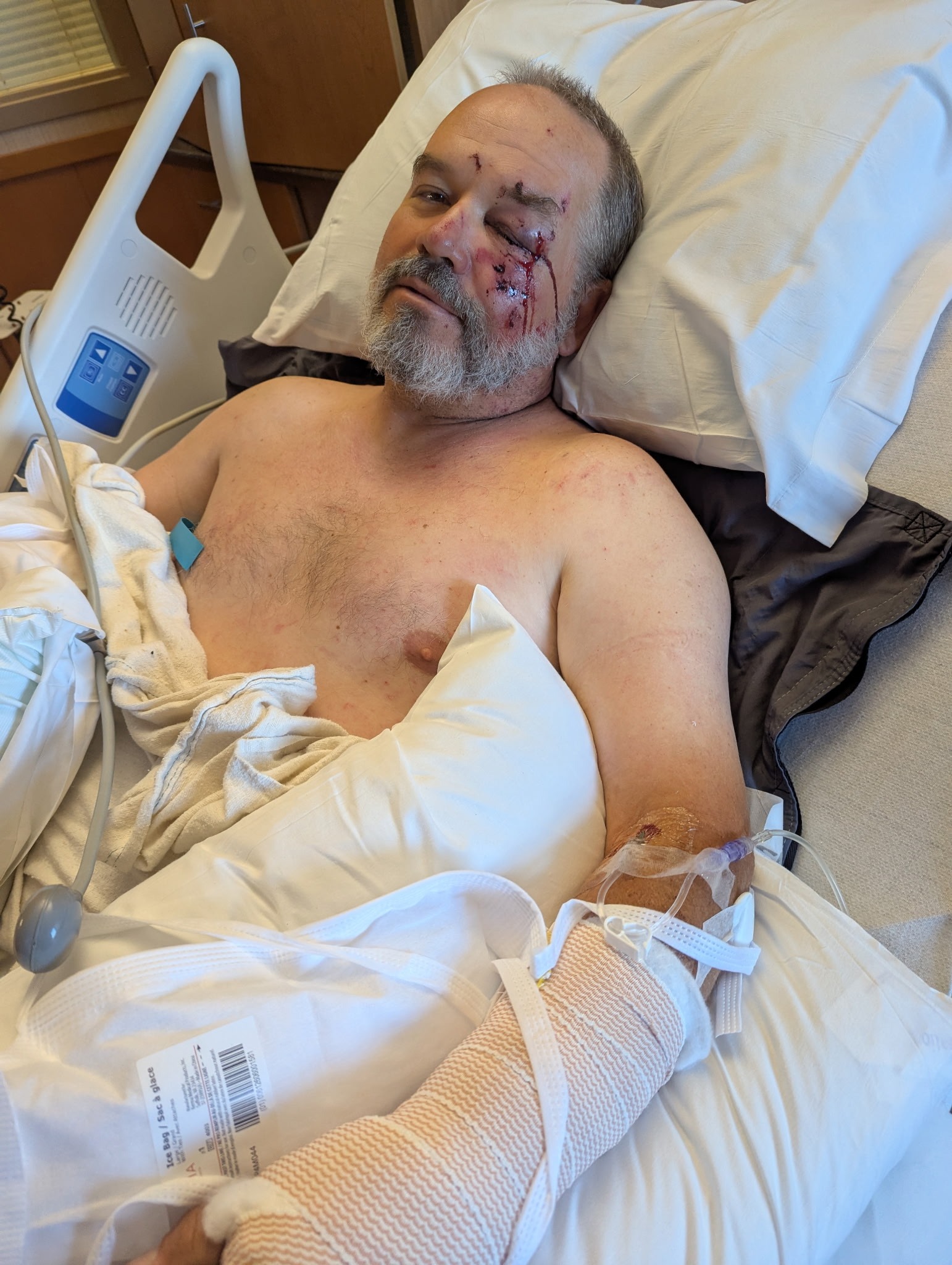 Support Dustin's Recovery After Severe Fall campaign photo, 4 of 5