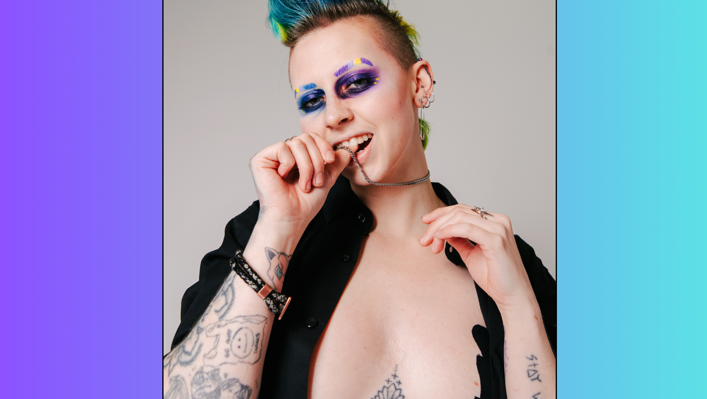 Artemis'  Top Surgery Recovery! photo