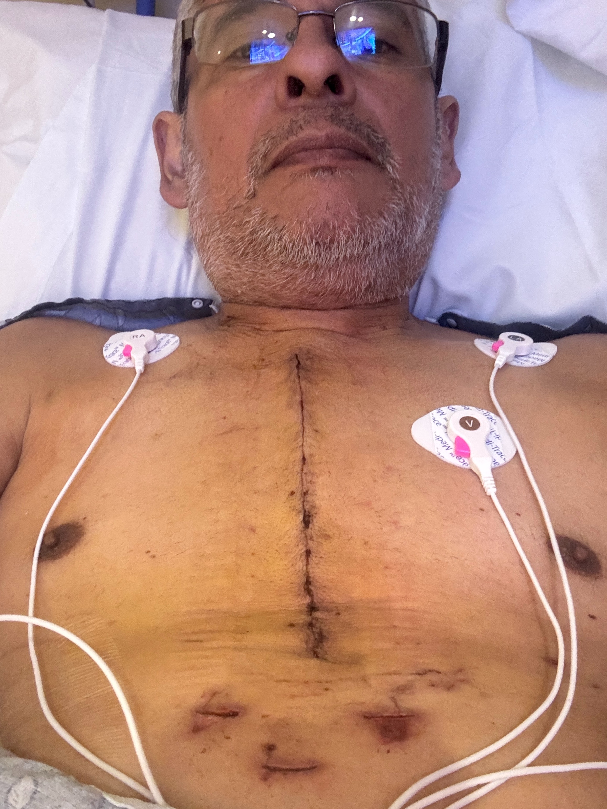 Support Elias Bodero's Heart Recovery Journey campaign photo, 2 of 6