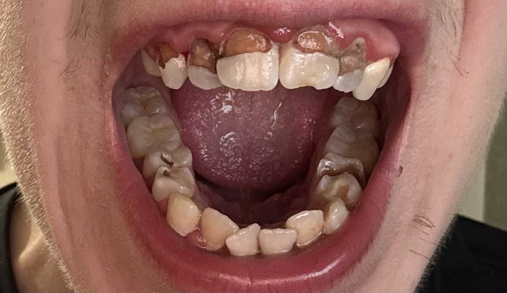 Help me Fix my Teeth campaign photo, 4 of 5