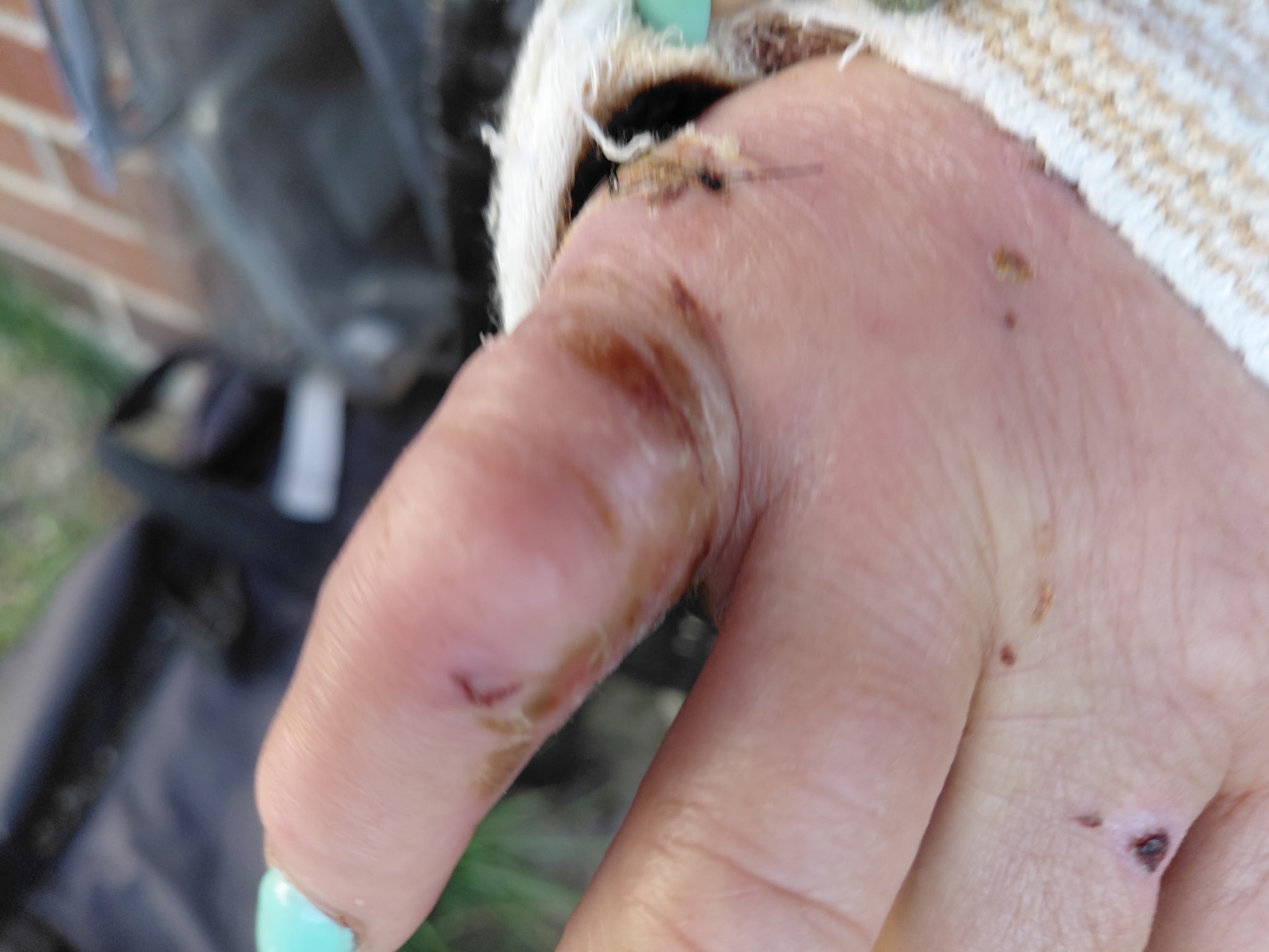 Support Donna's Recovery After Dog Bite campaign photo, 6 of 7