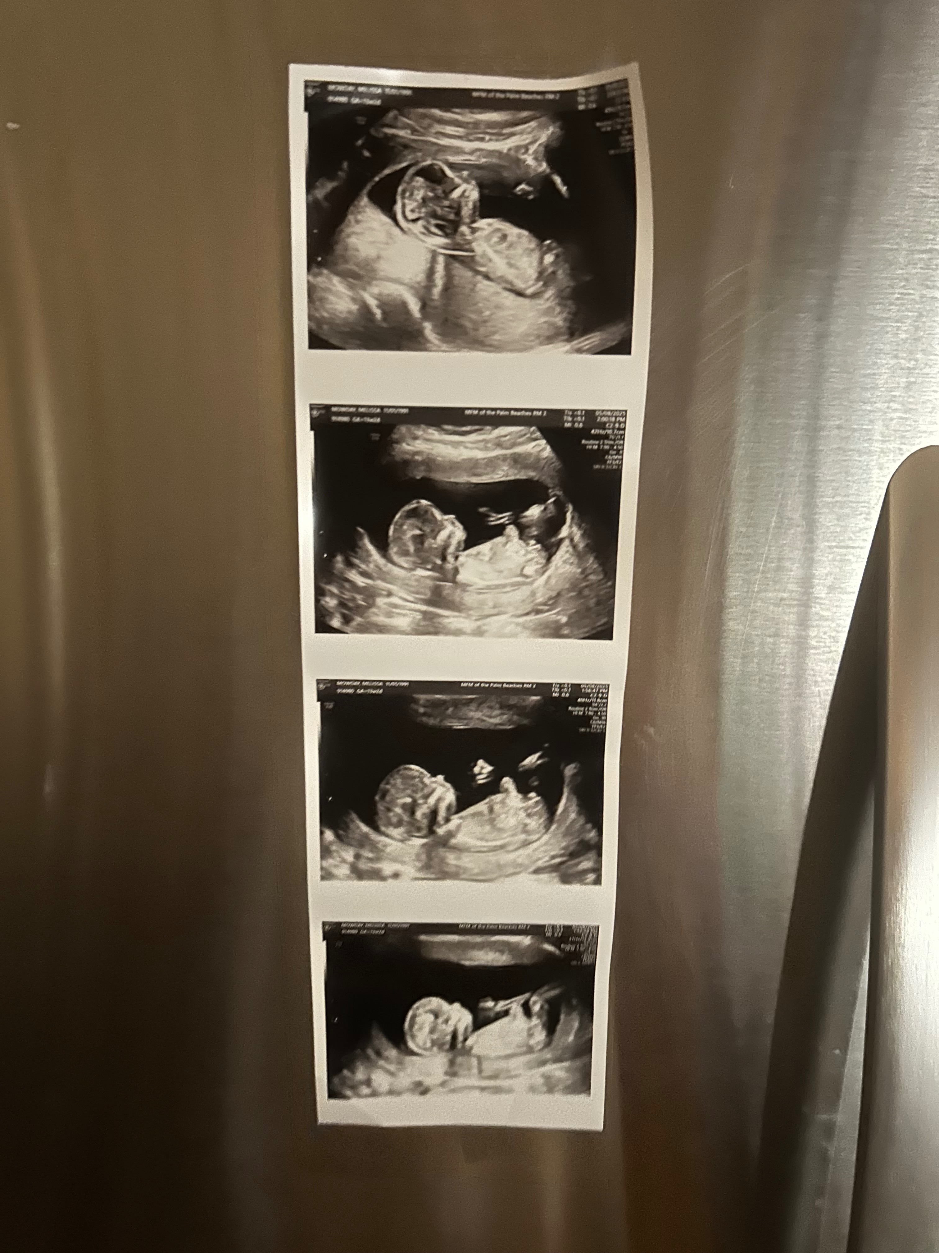 Prayers and Support for Baby James and the Mowdays campaign photo, 2 of 8