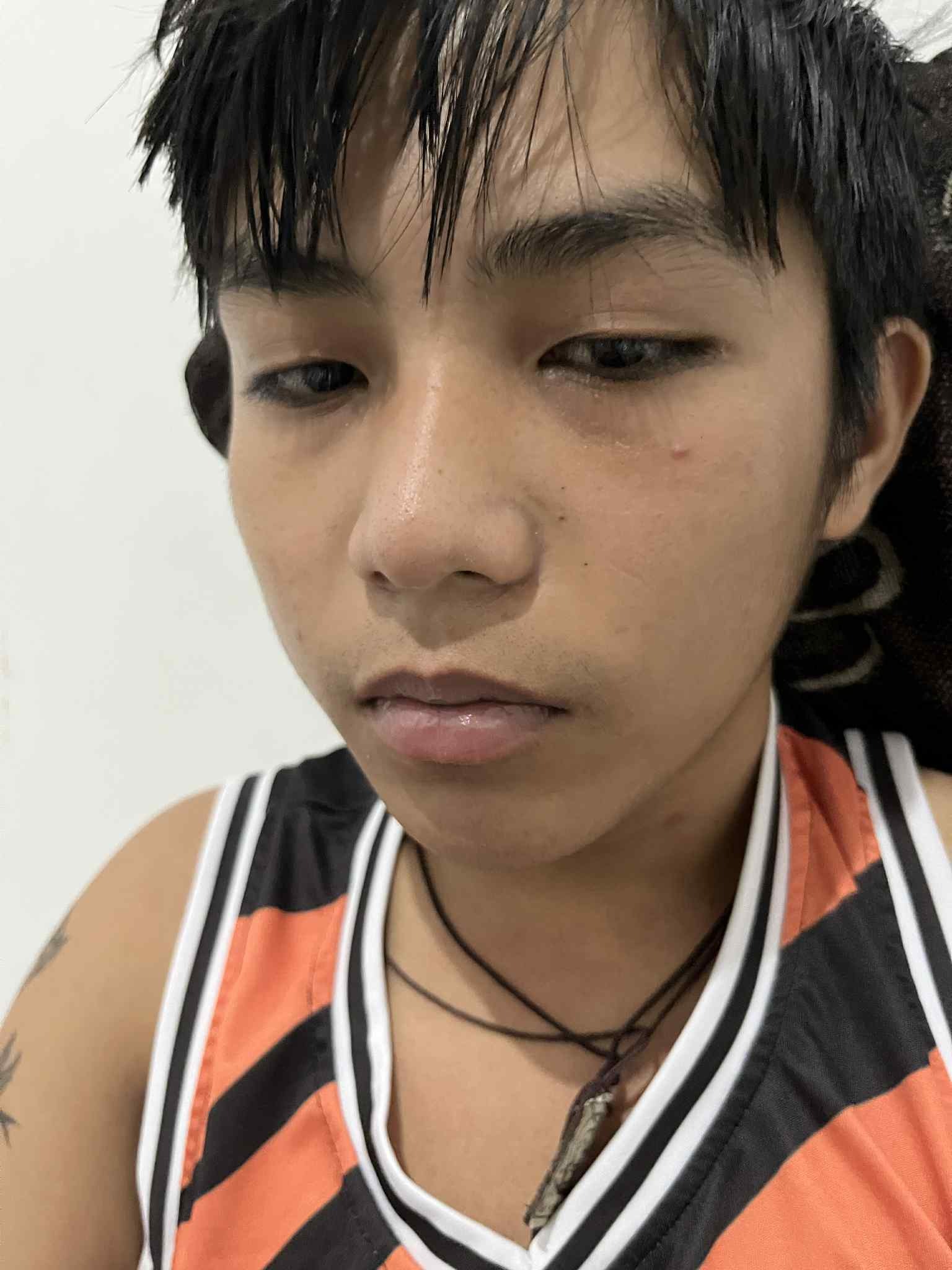 Urgent Help Needed: 19-Year-Old Fighting Kidney Failure campaign photo, 2 of 7