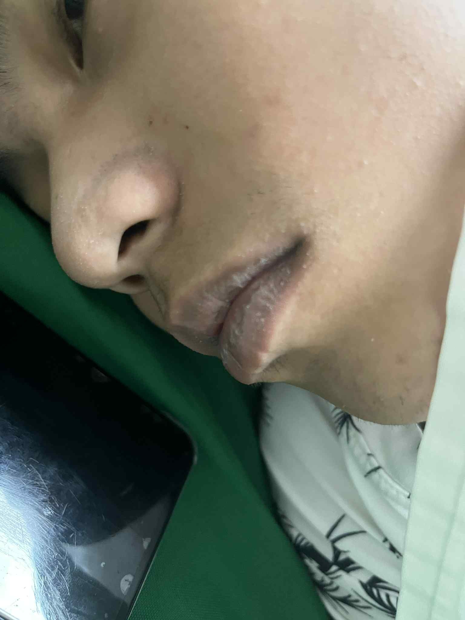 Urgent Help Needed: 19-Year-Old Fighting Kidney Failure campaign photo, 4 of 7