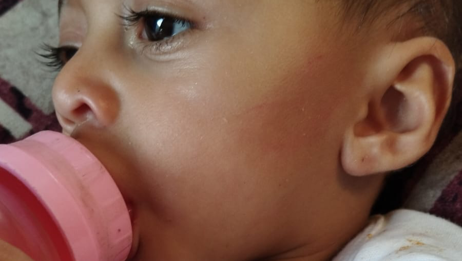 Aidez Nour (11mois, 5kgs) et sa famille à survivre