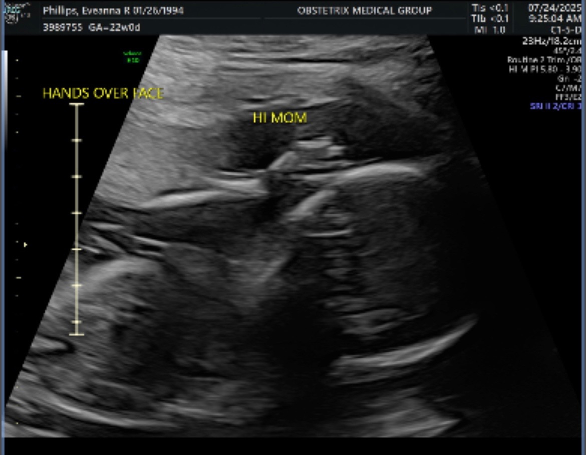 Urgent Aid for Expectant Mother in Crisis campaign photo, 4 of 7