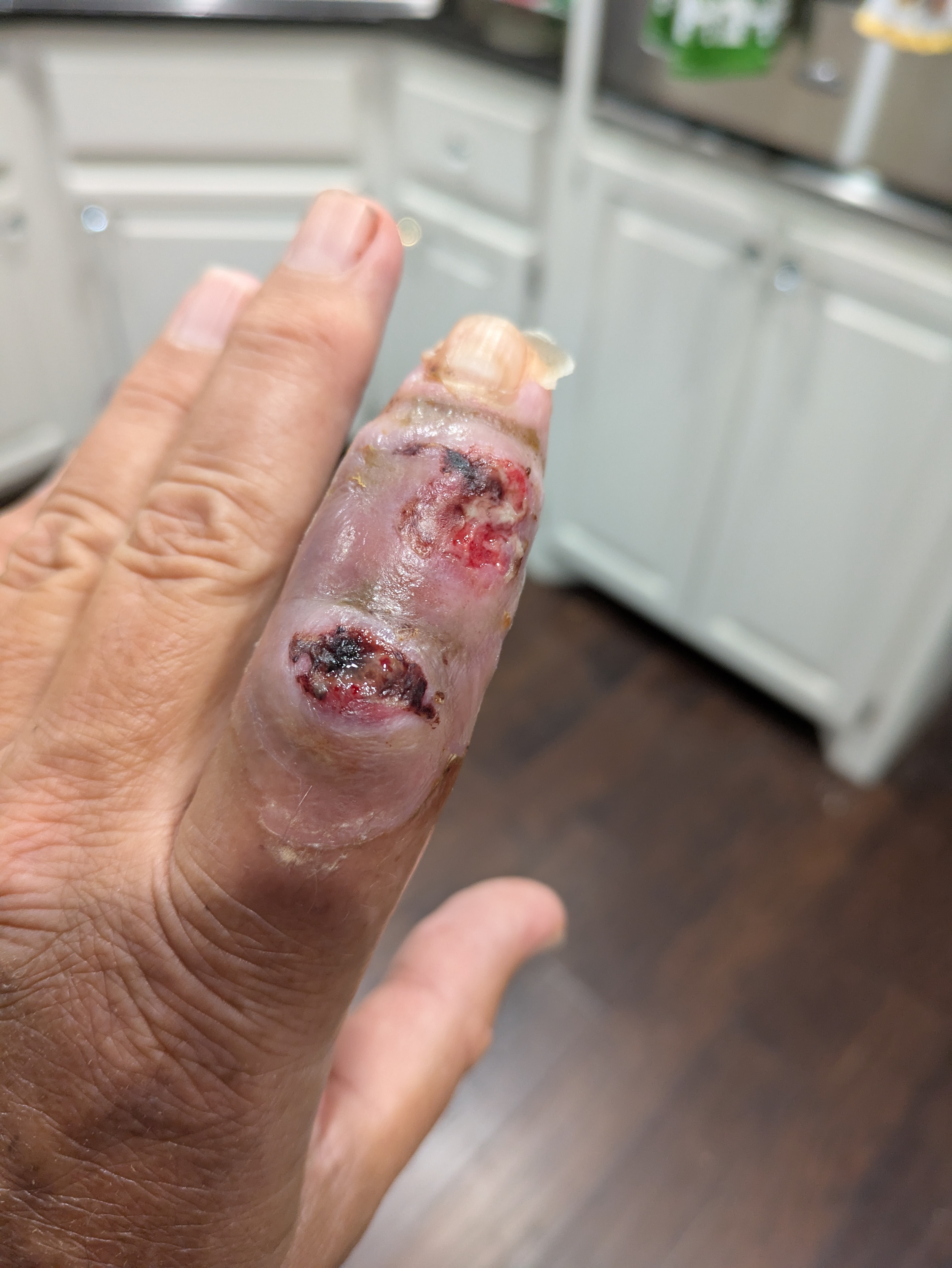 Support Steve’s Recovery After Work Injury campaign photo, 2 of 8