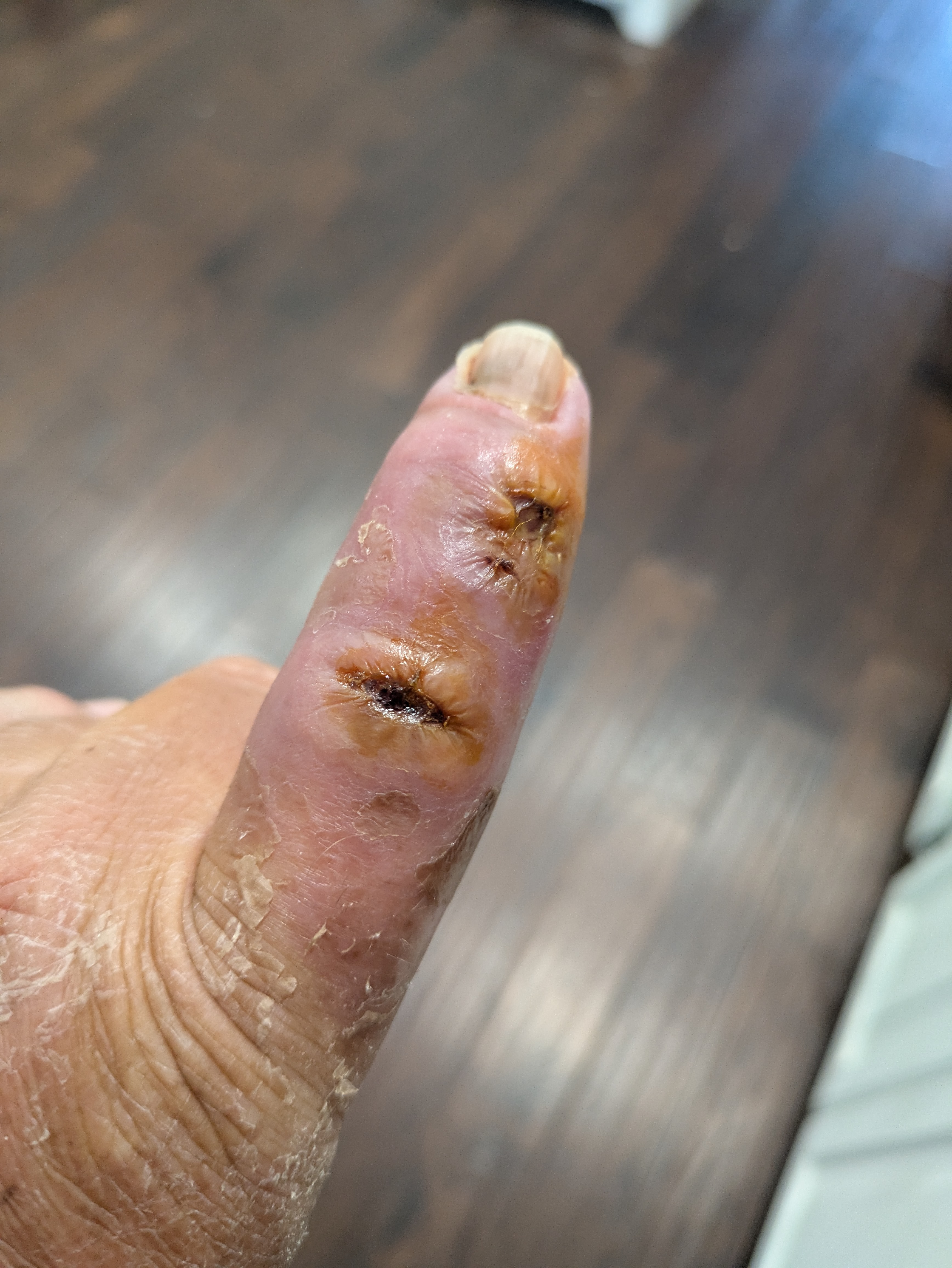 Support Steve’s Recovery After Work Injury campaign photo, 5 of 8
