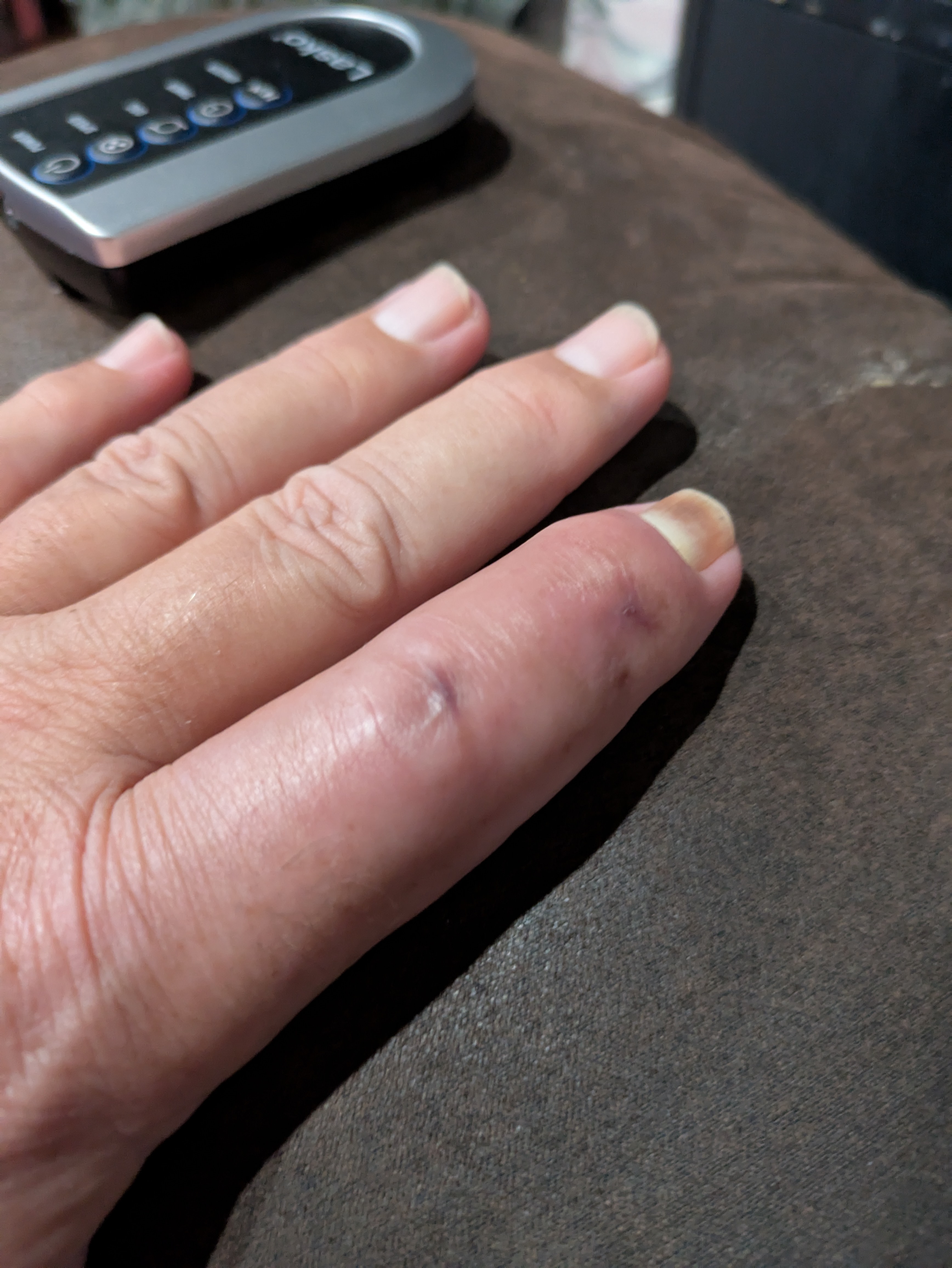 Support Steve’s Recovery After Work Injury campaign photo, 6 of 8