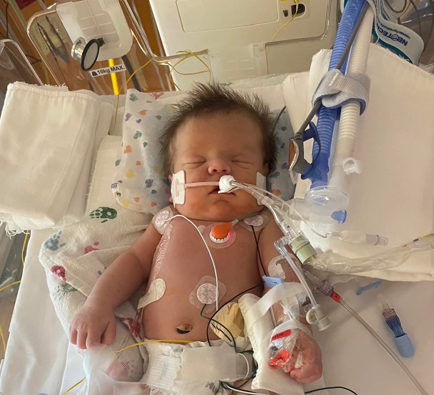 Support Baby Apollo's Medical Journey campaign photo, 2 of 4