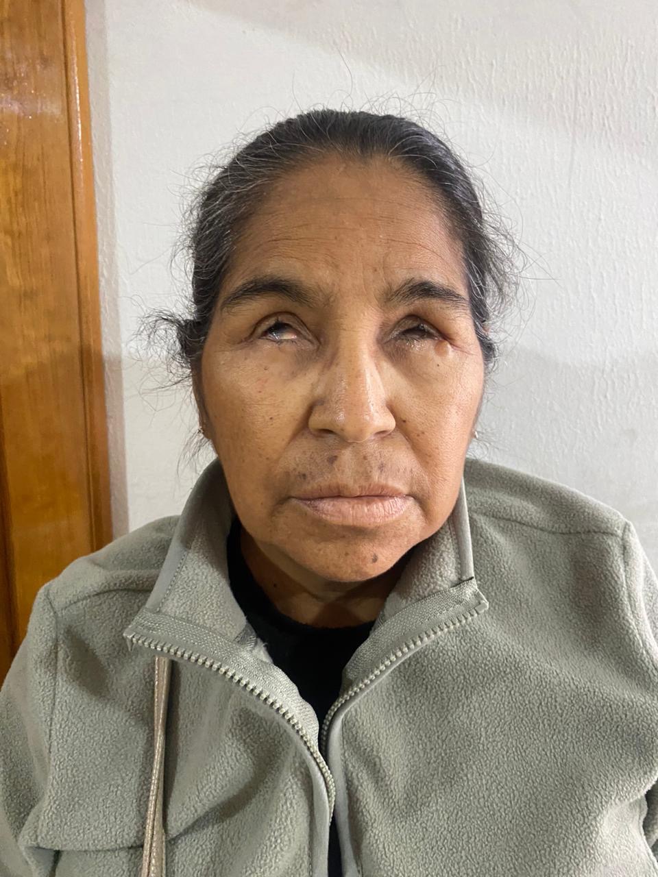 Support Lupe: Vision Lost, Kidneys Failing campaign photo, 2 of 4