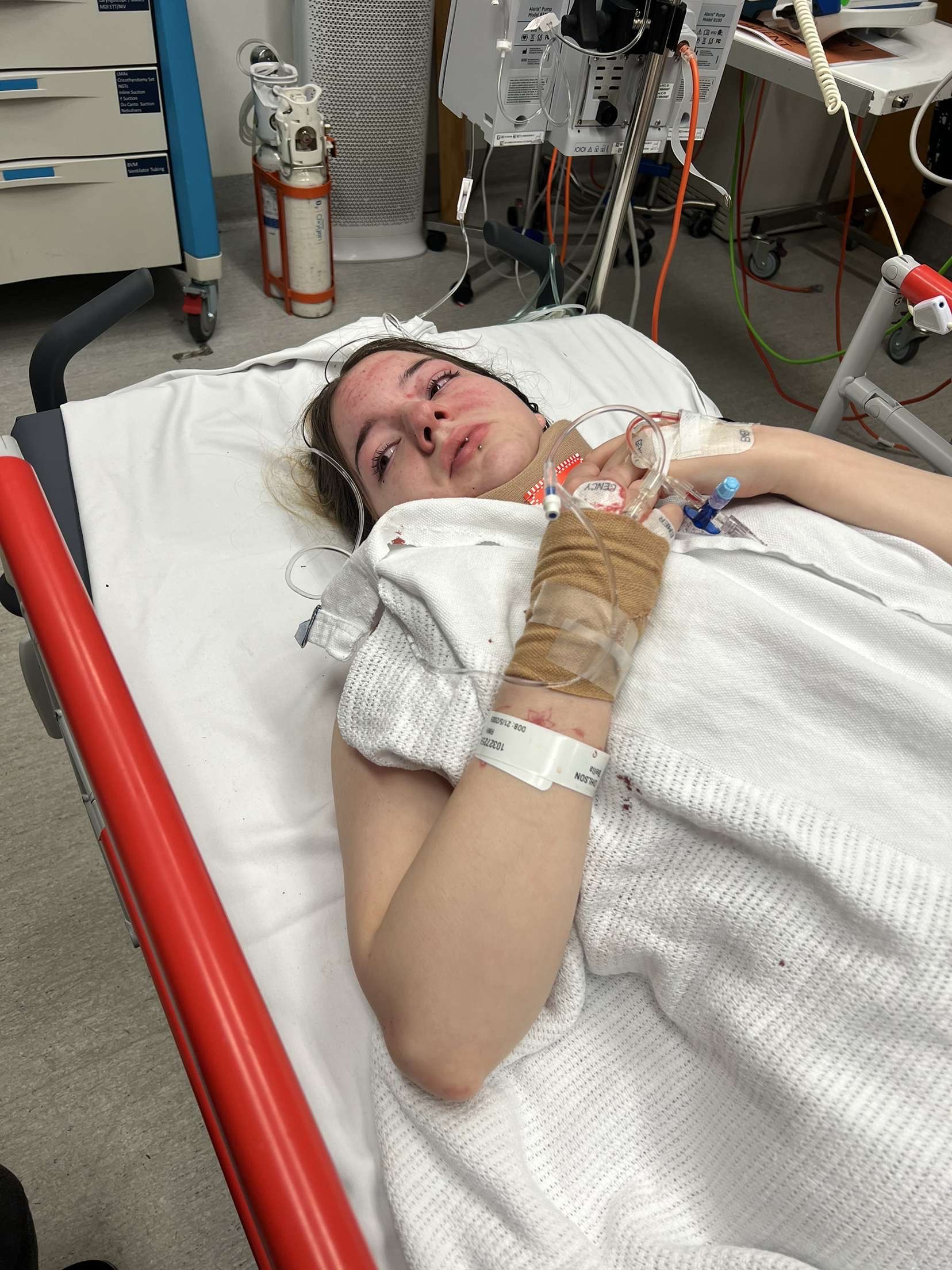 Help Bella recover from a traumatic injury campaign photo, 7 of 8